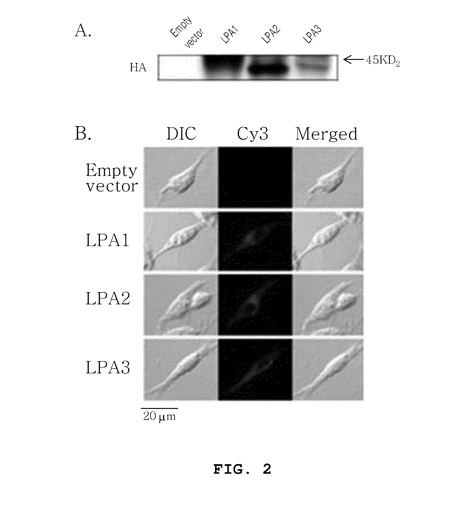 Use for glycolipoprotein gintonin, isolated and identified from ginseng, as a natural medical-plant derived ligand