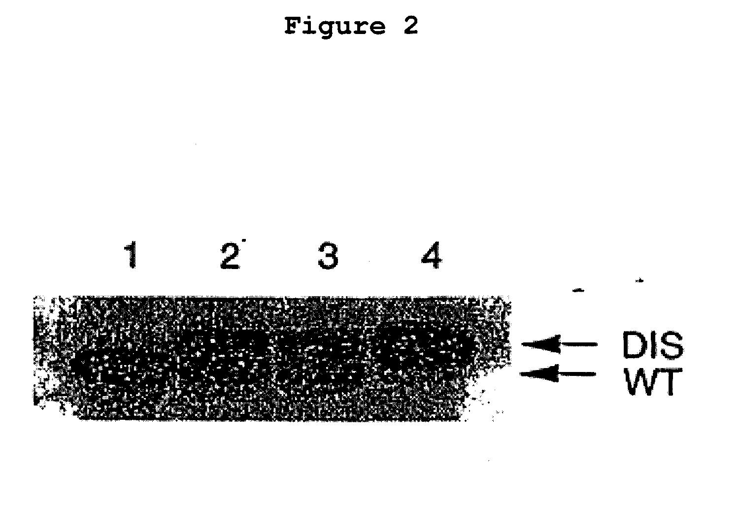 Osteopontin Specific Antibodies and Methods of Use Thereof