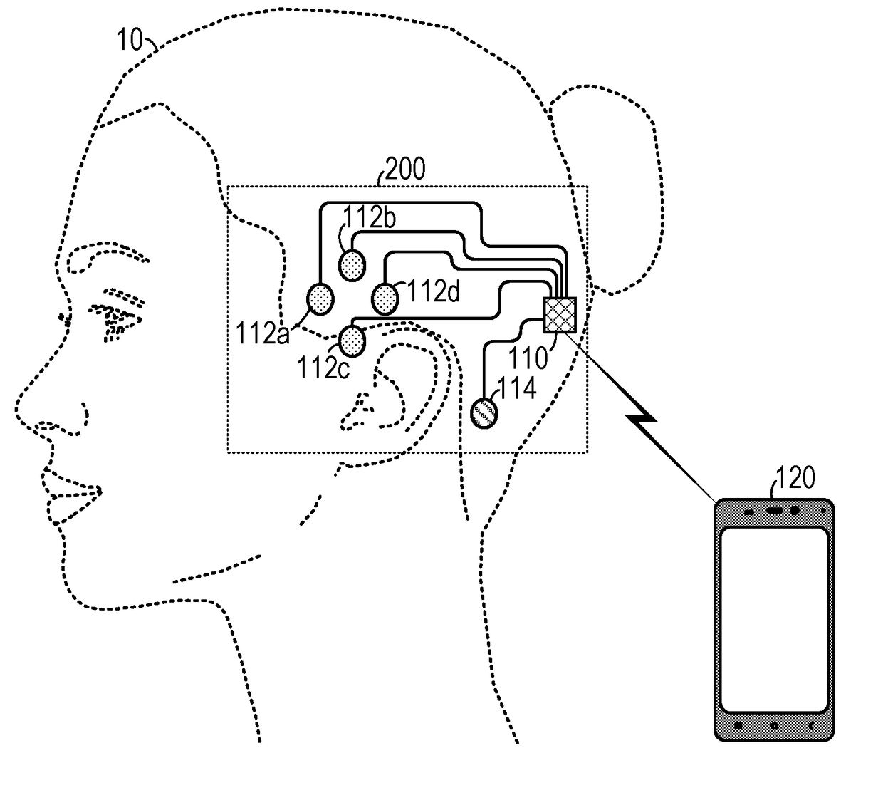 Speech Prosthesis Employing Beta Peak Detection