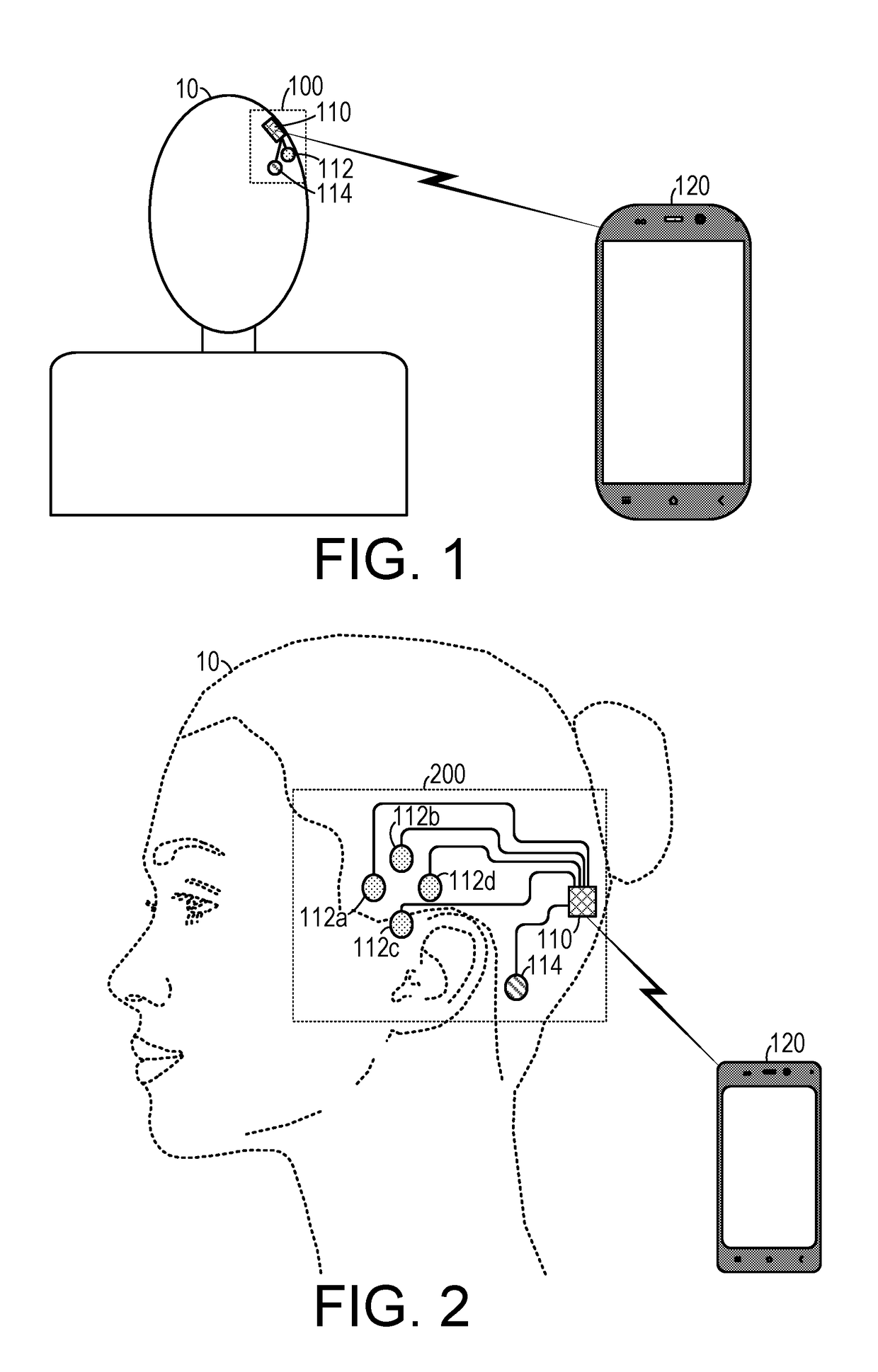 Speech Prosthesis Employing Beta Peak Detection