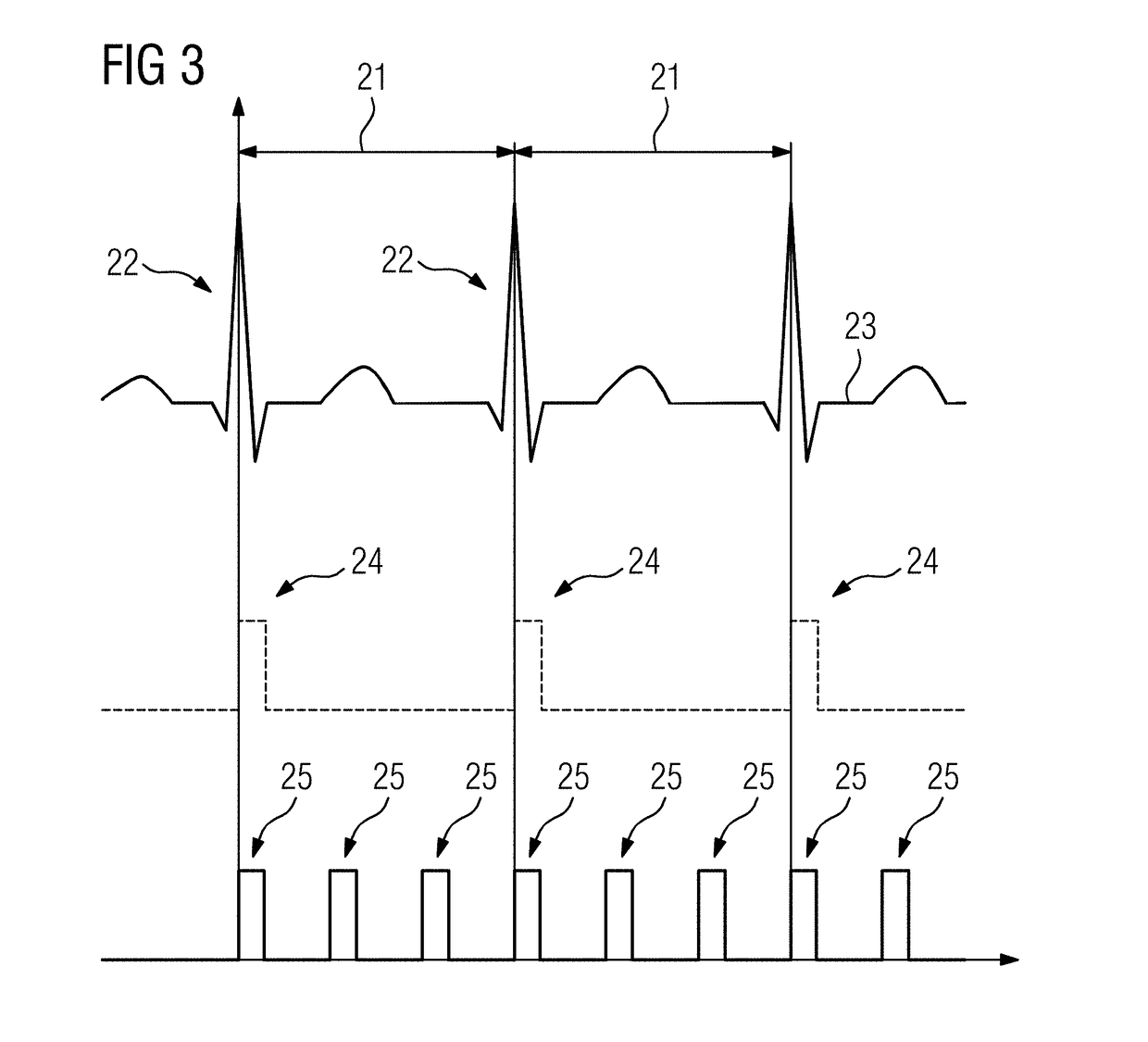 Method for acquiring x-ray data, x-ray device, computer program and electronically readable storage medium