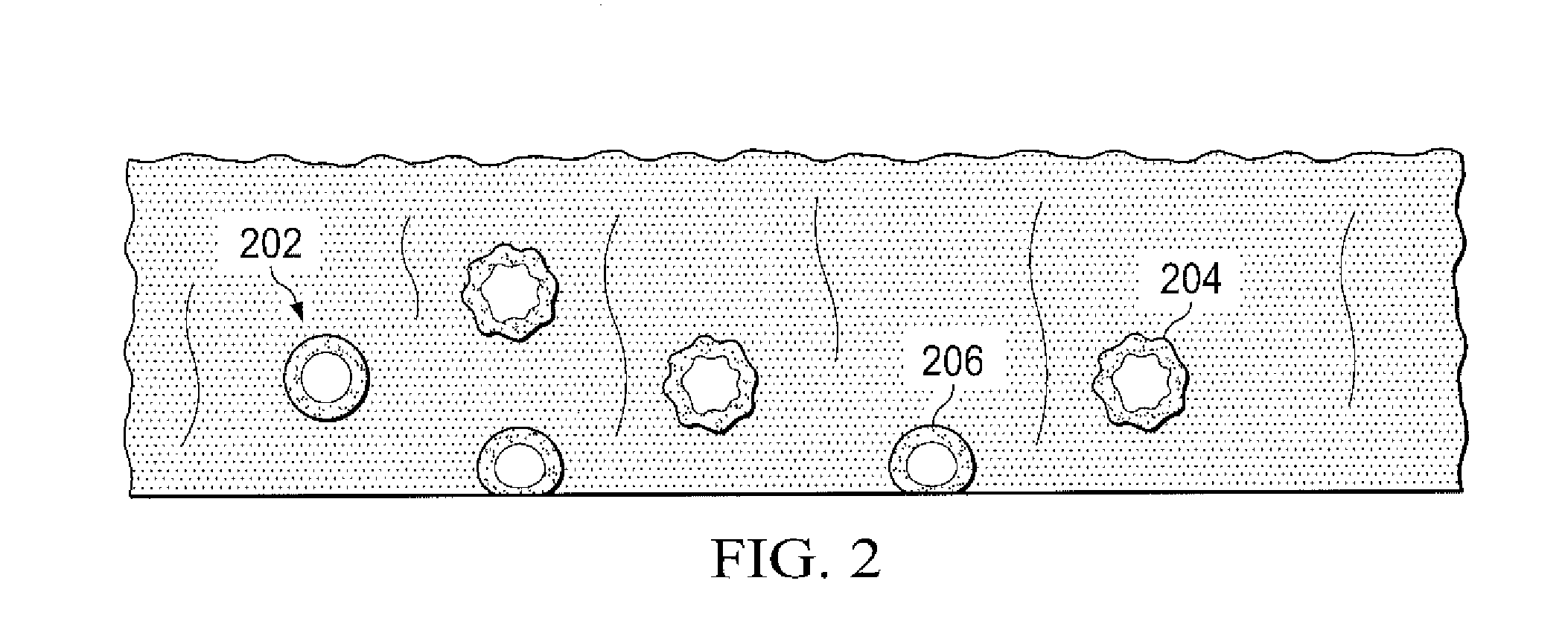 Wound debridement by irrigation with ultrasonically activated microbubbles