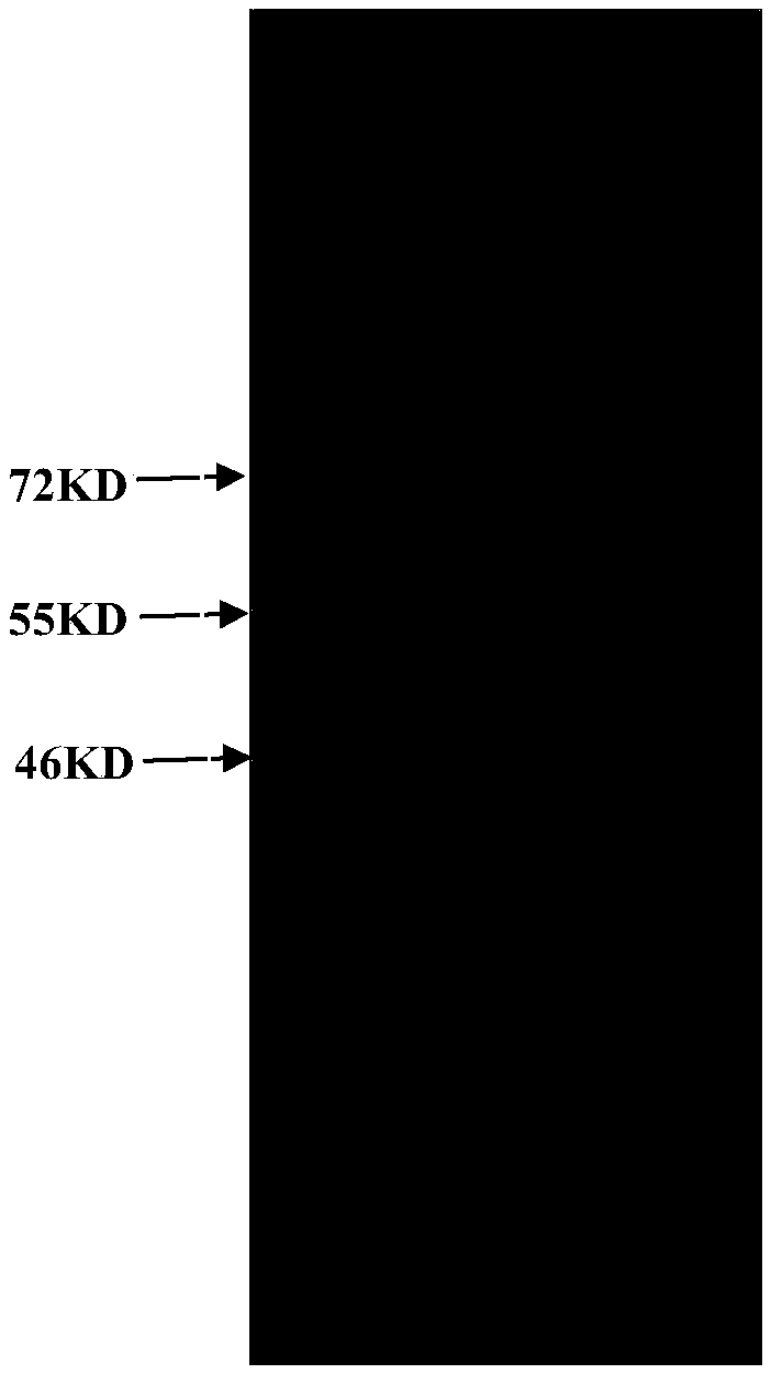 Method and special kit for detection of porcine cytomegalovirus antibody