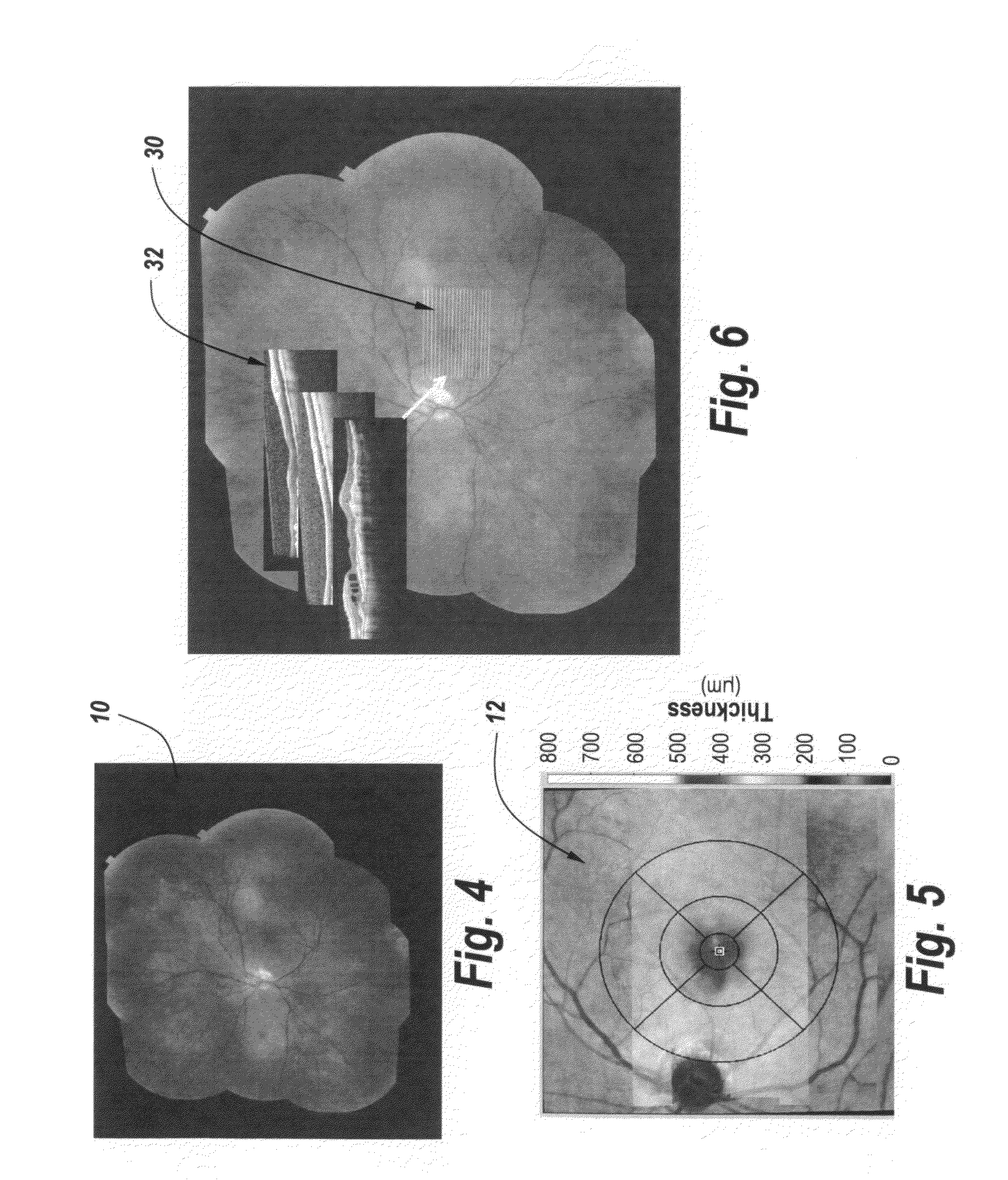 Multimodality correlation of optical coherence tomography using secondary reference images