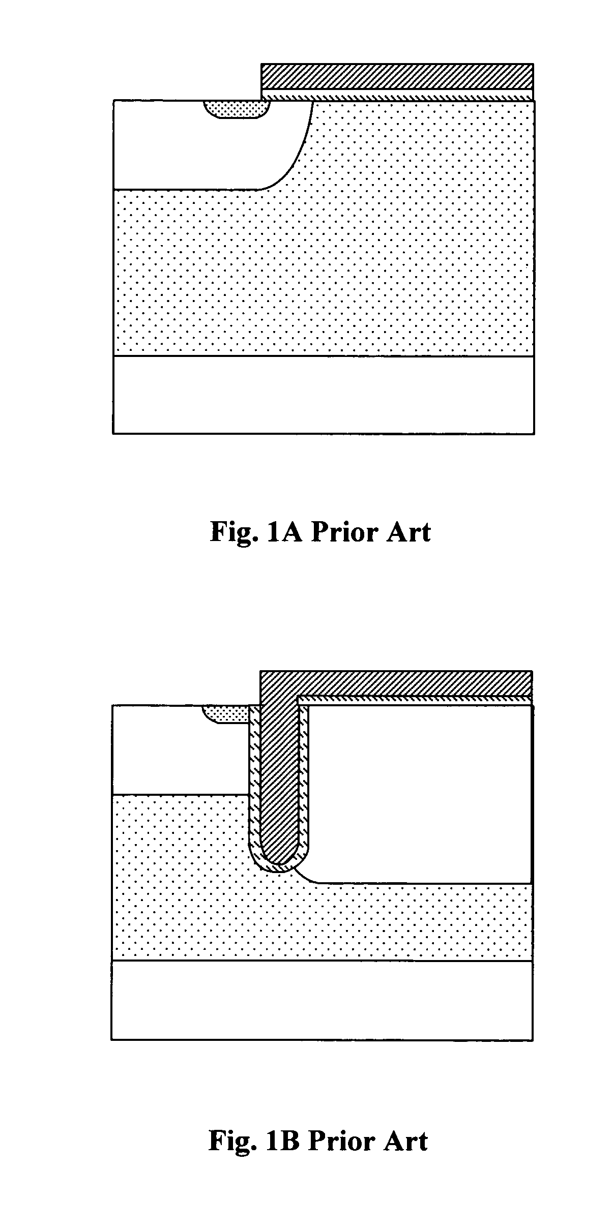 Topside structures for an insulated gate bipolar transistor (IGBT) device to achieve improved device performances