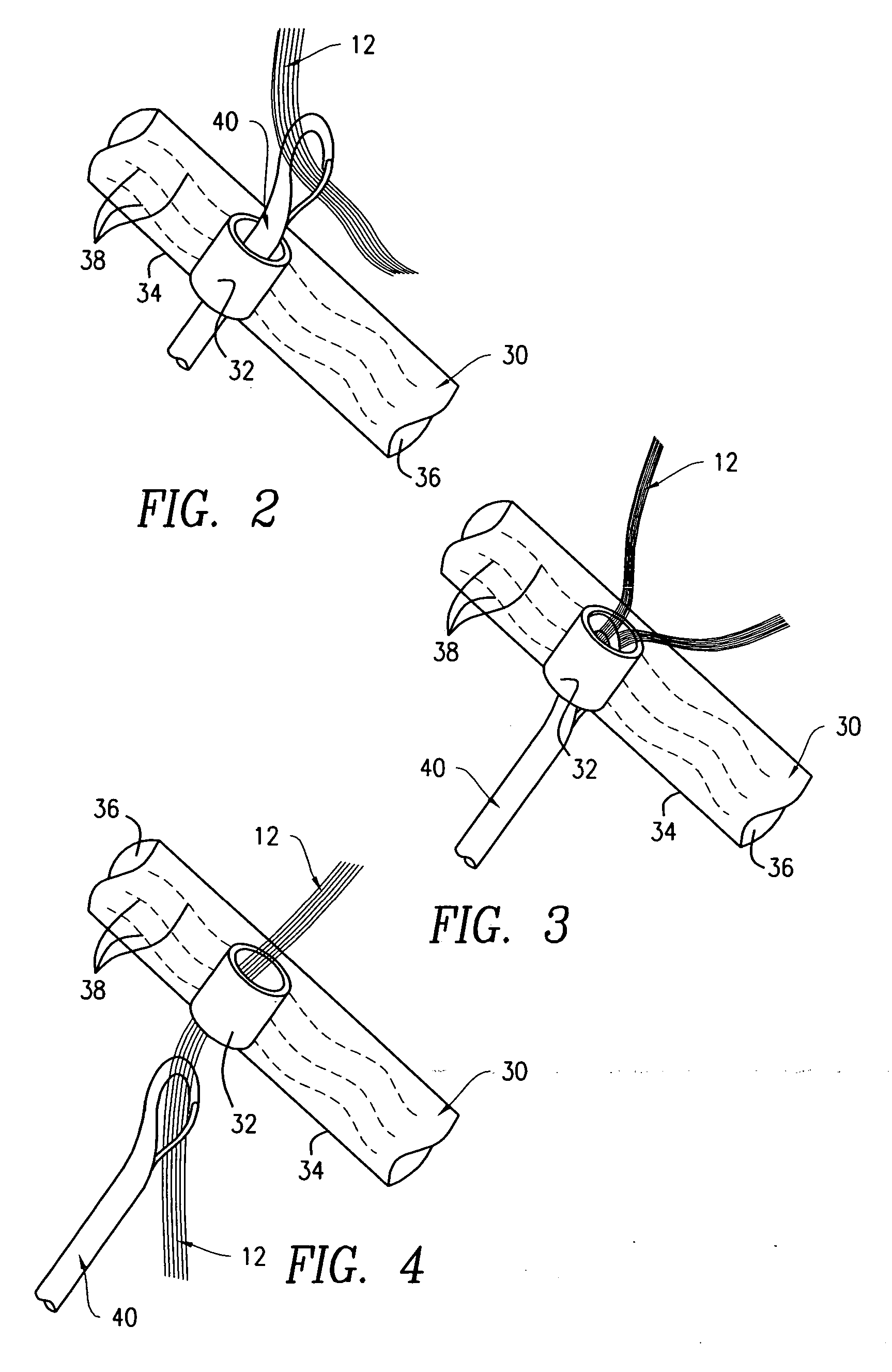 Hairpiece with attachment rings and heating kit for attaching hairpiece