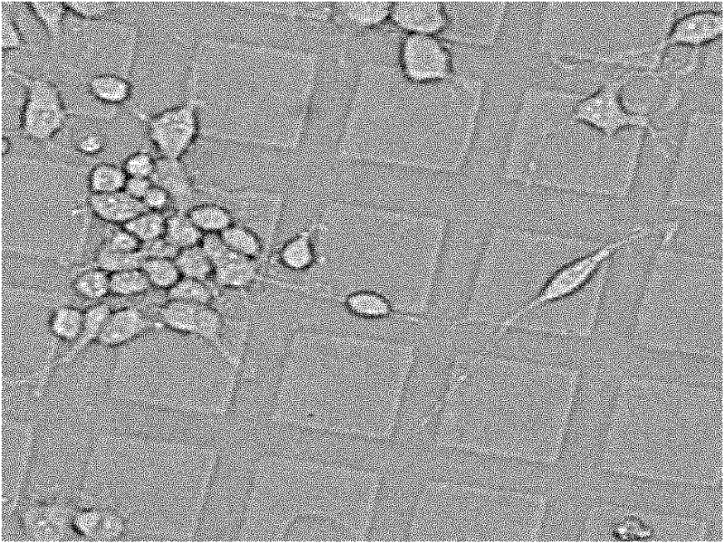 High density cell tracking method based on topological constraint and Hungarian algorithm