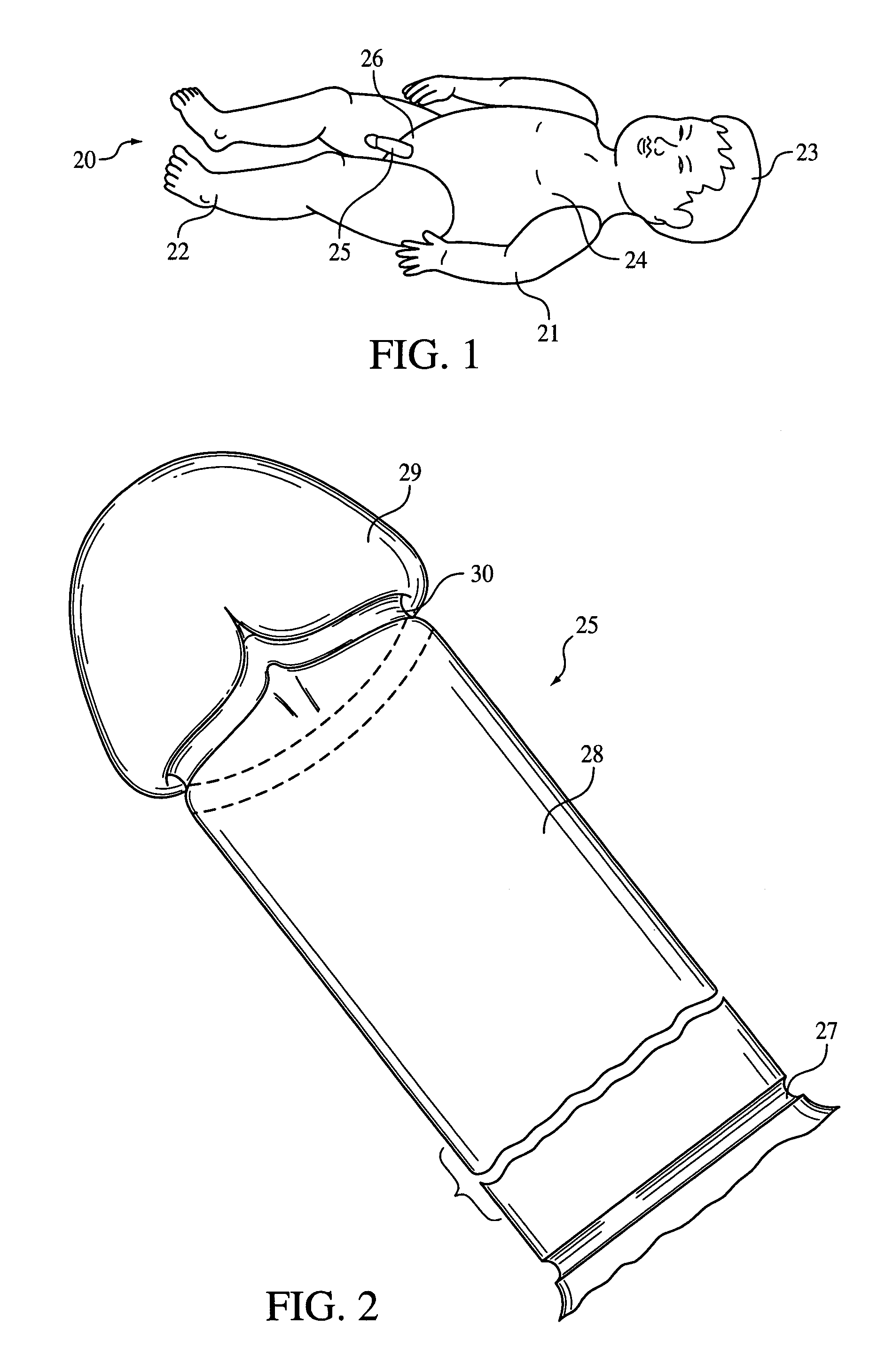 Simulated disposable foreskin for training surgical procedure of infant circumcision