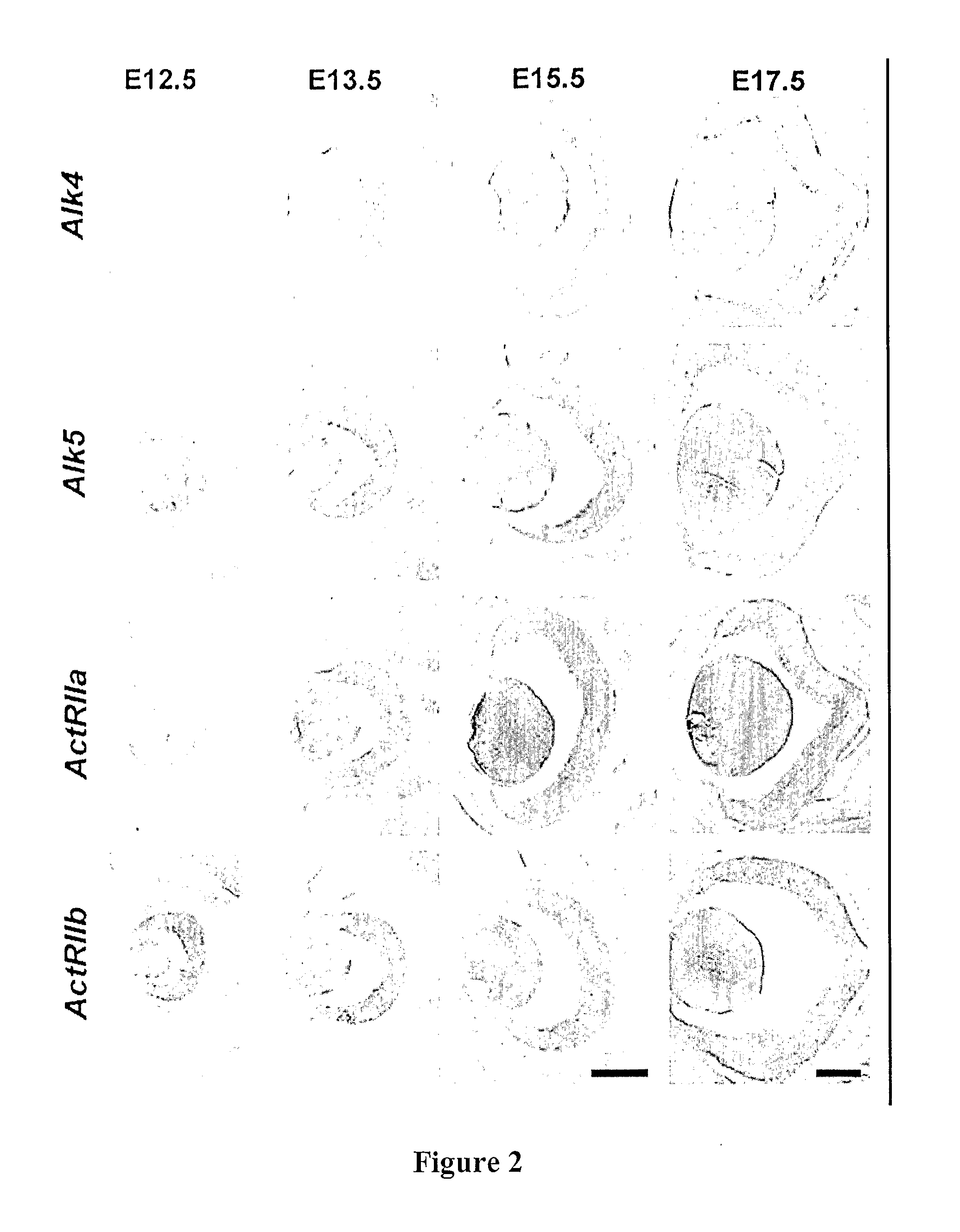 Compositions And Methods For Treatment of Neural Disorders Using Transforming Growth Factor-Beta Superfamily Proteins And Their Antagonists