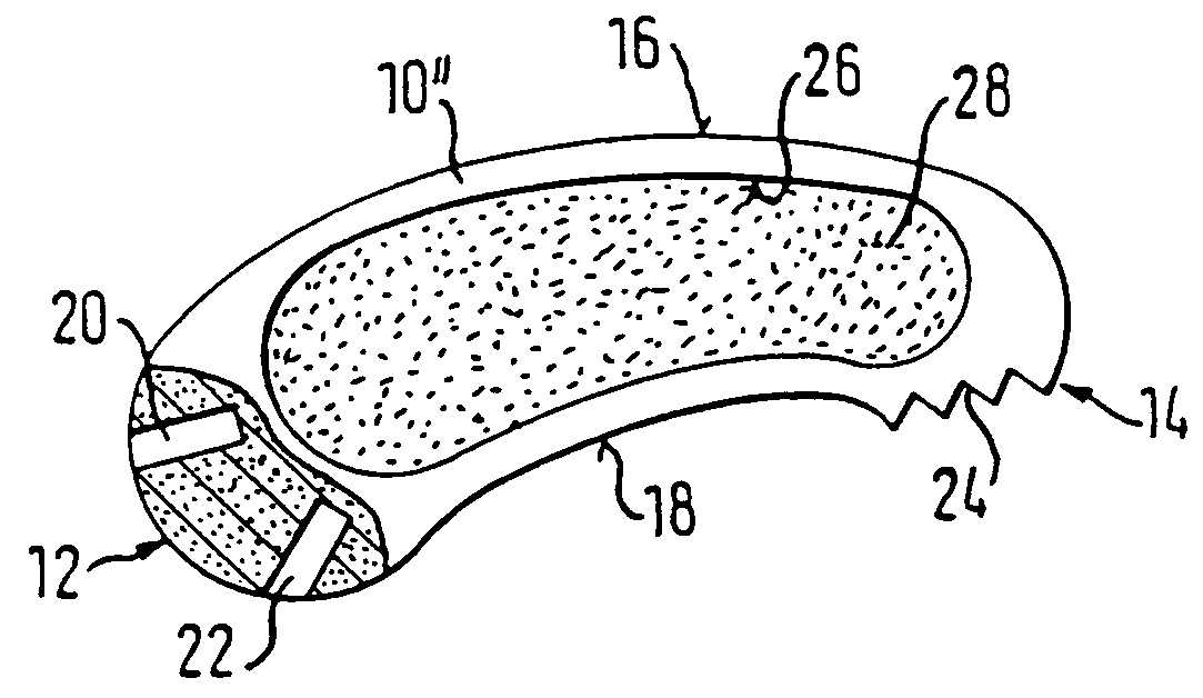 Implant consisting of bone material