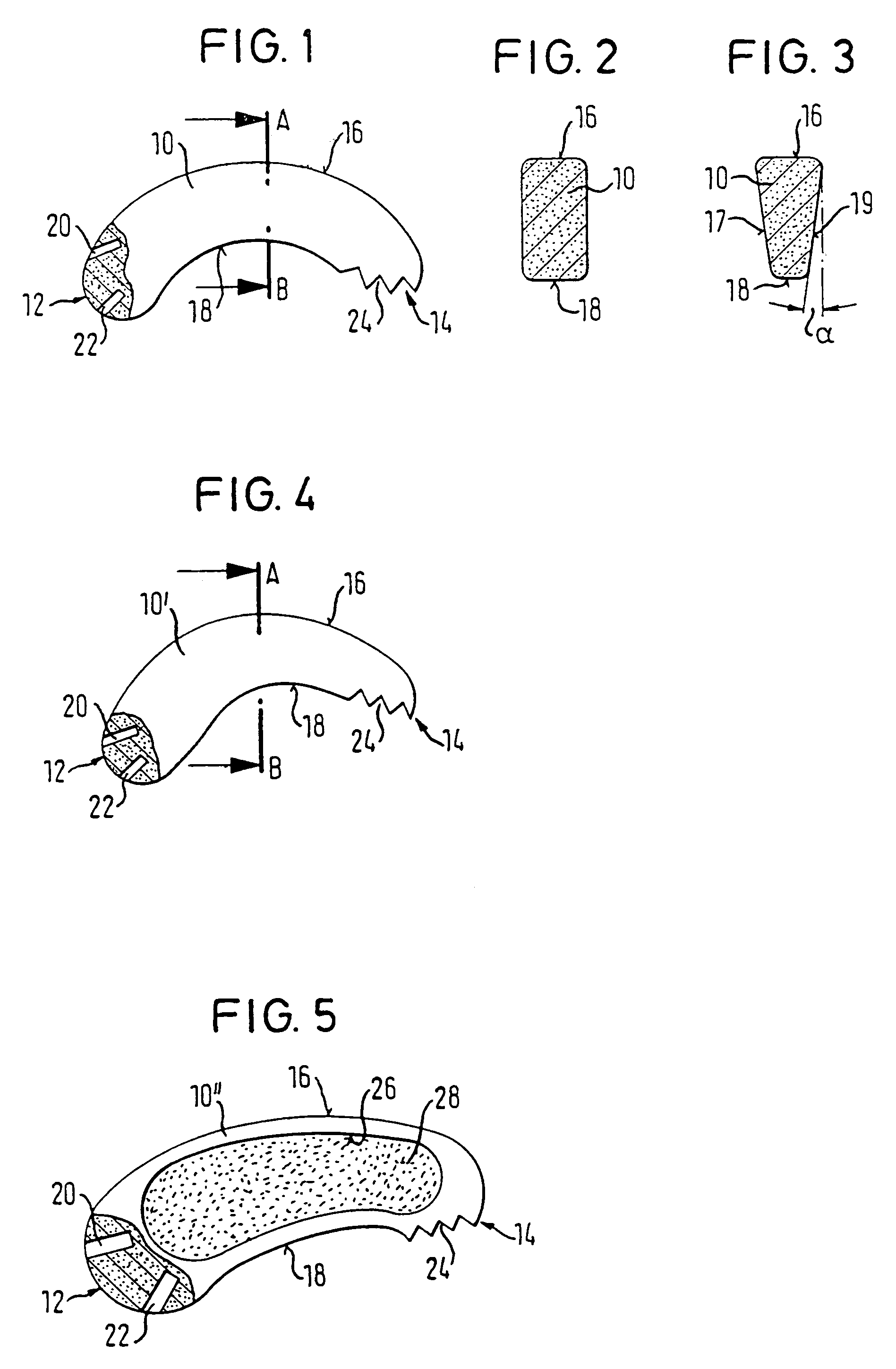 Implant consisting of bone material