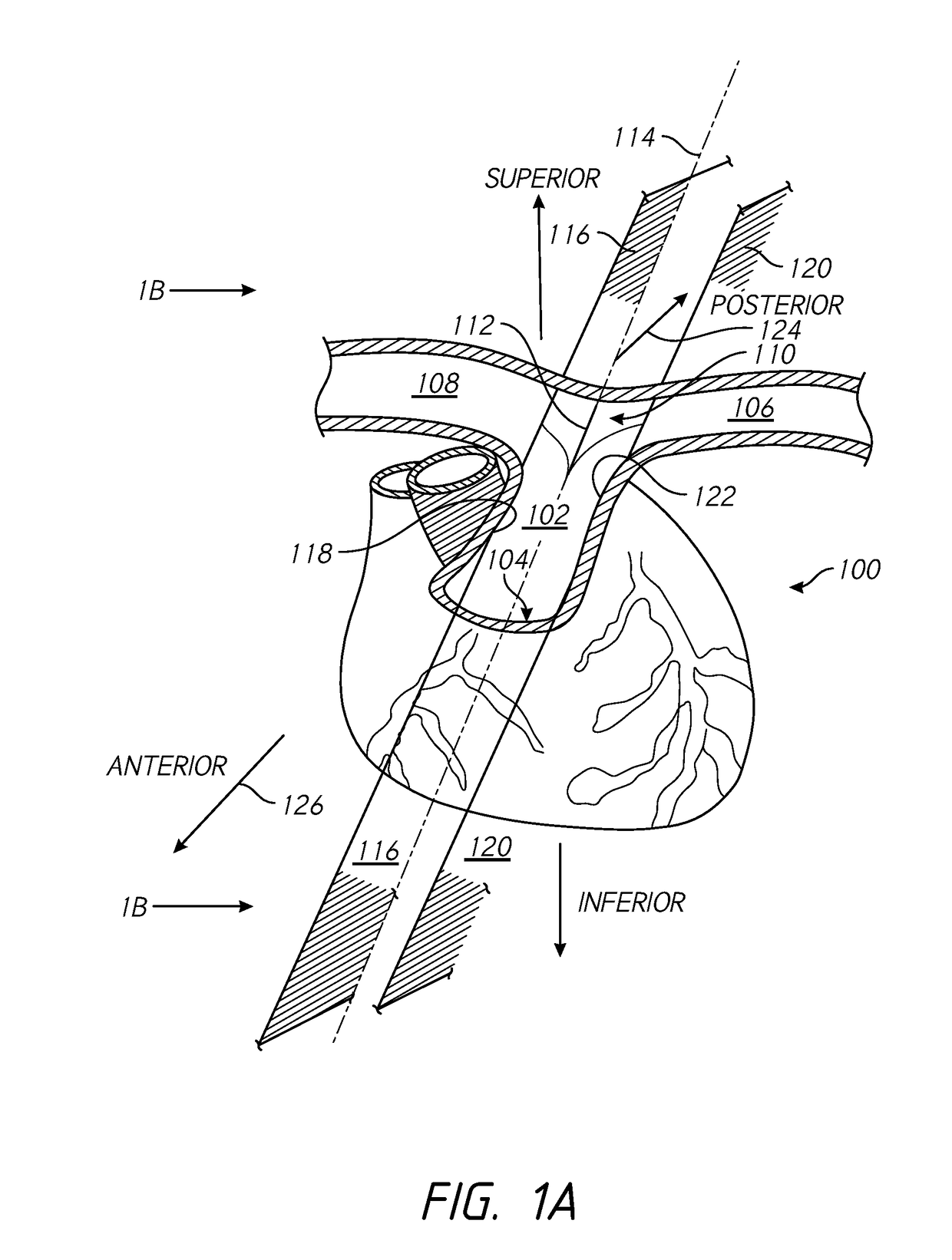 Cardiac modulation facilitation methods and systems