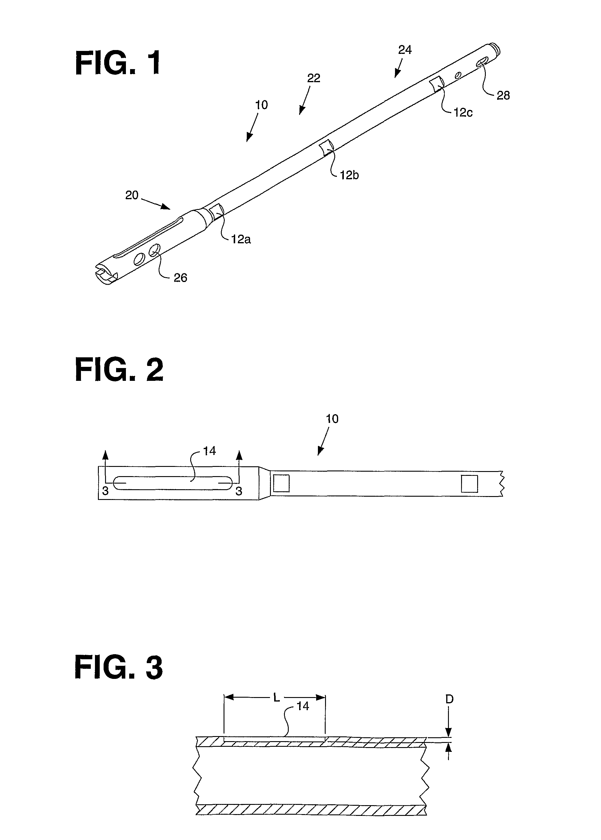 Telemetric Orthopaedic Implant