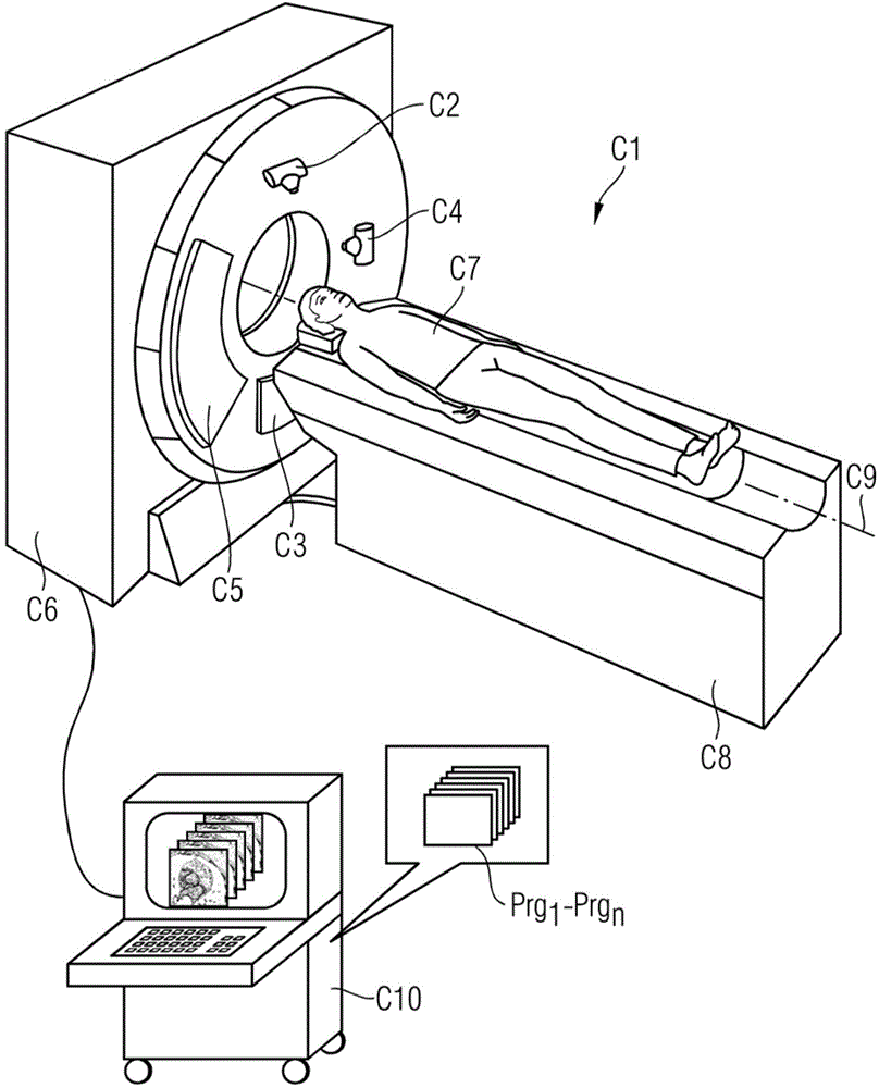 CT system