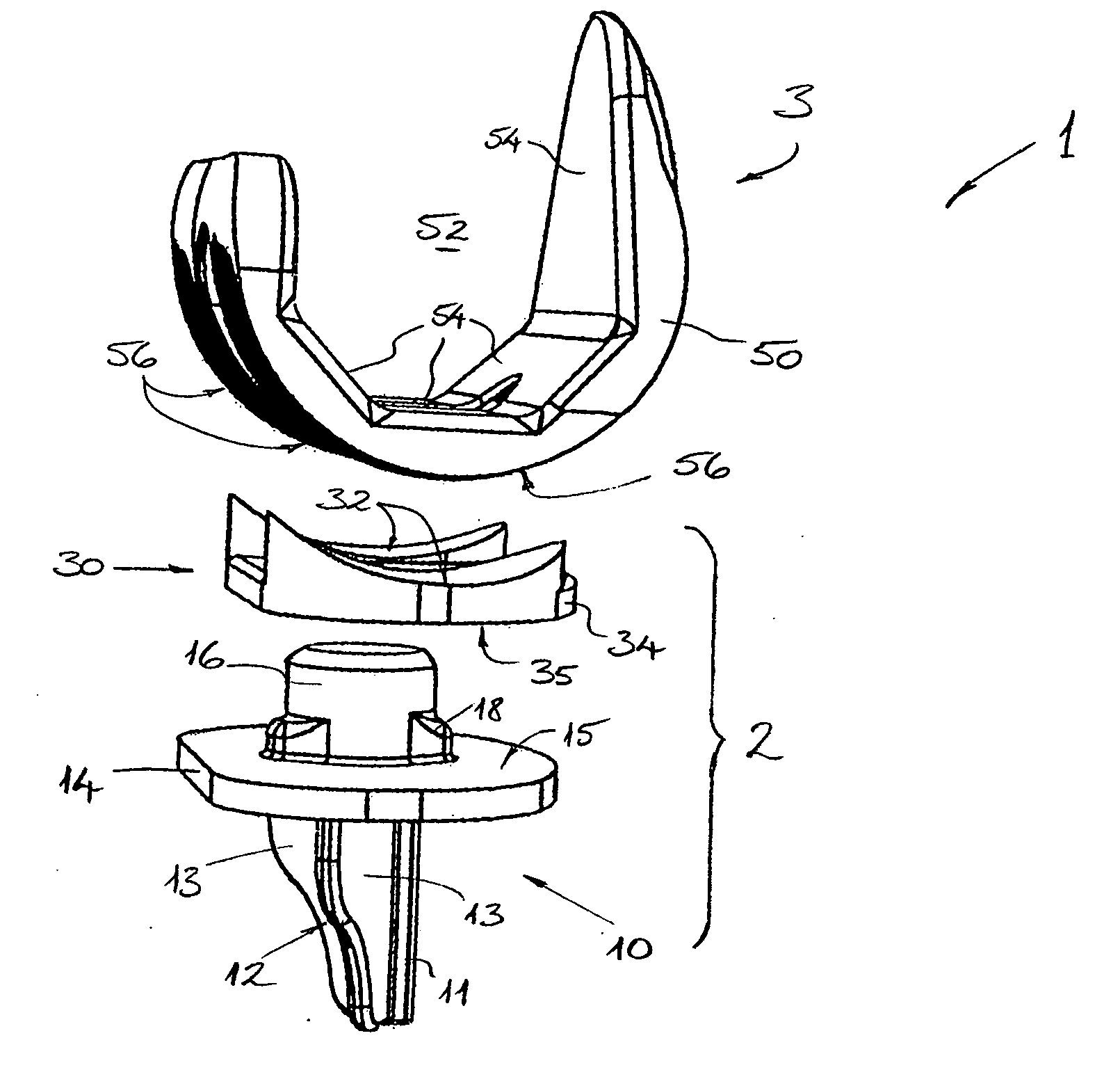 Knee joint prosthesis and related method
