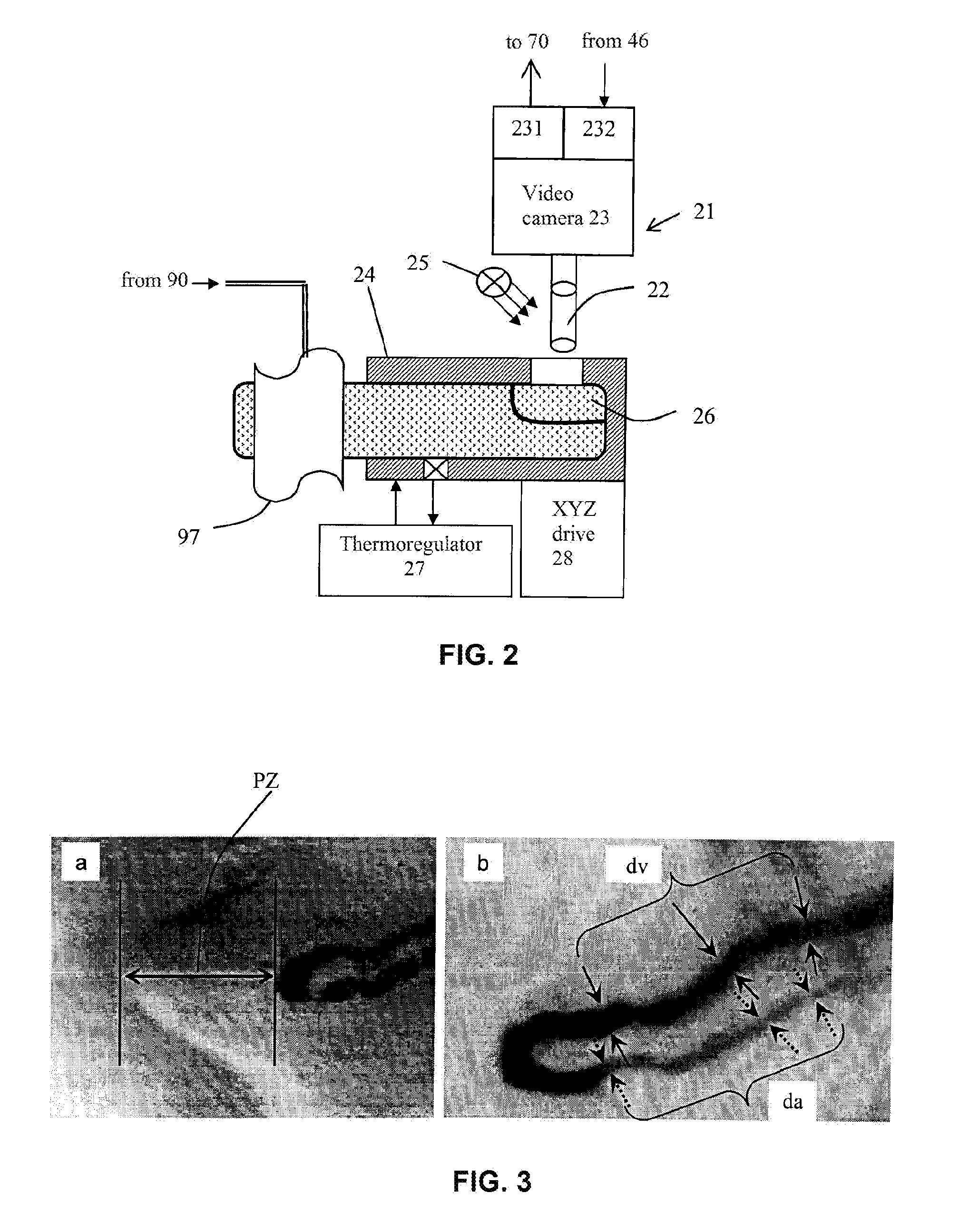 Method and Device for Assessing the Risk of Cardiovascular Complications