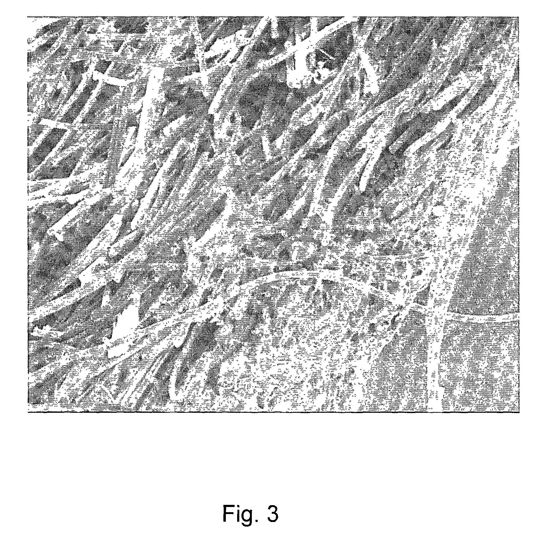 Hybrid biologic/synthetic porous extracellular matrix scaffolds