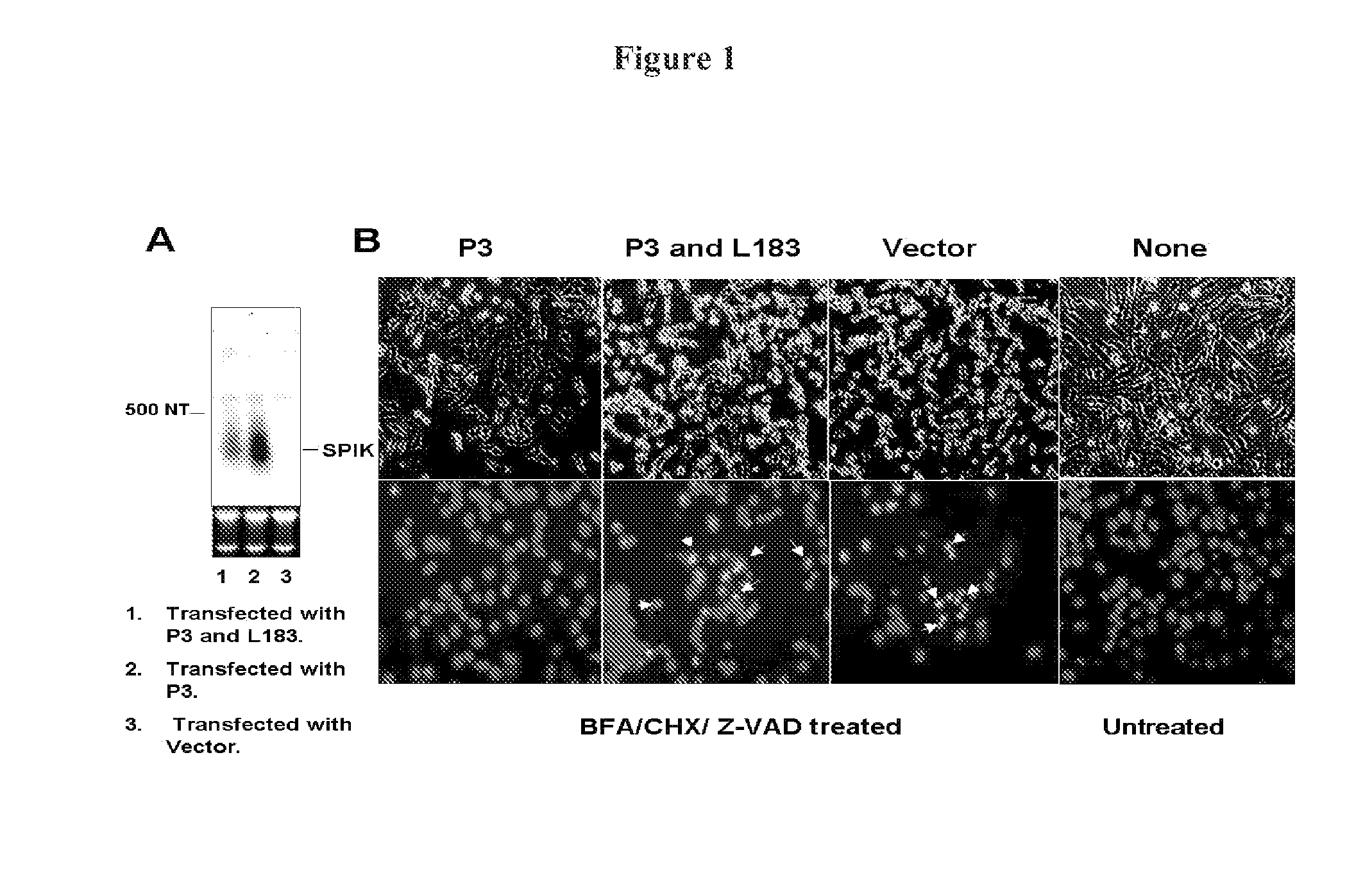 Serine protease inhibitor kazal antibodies