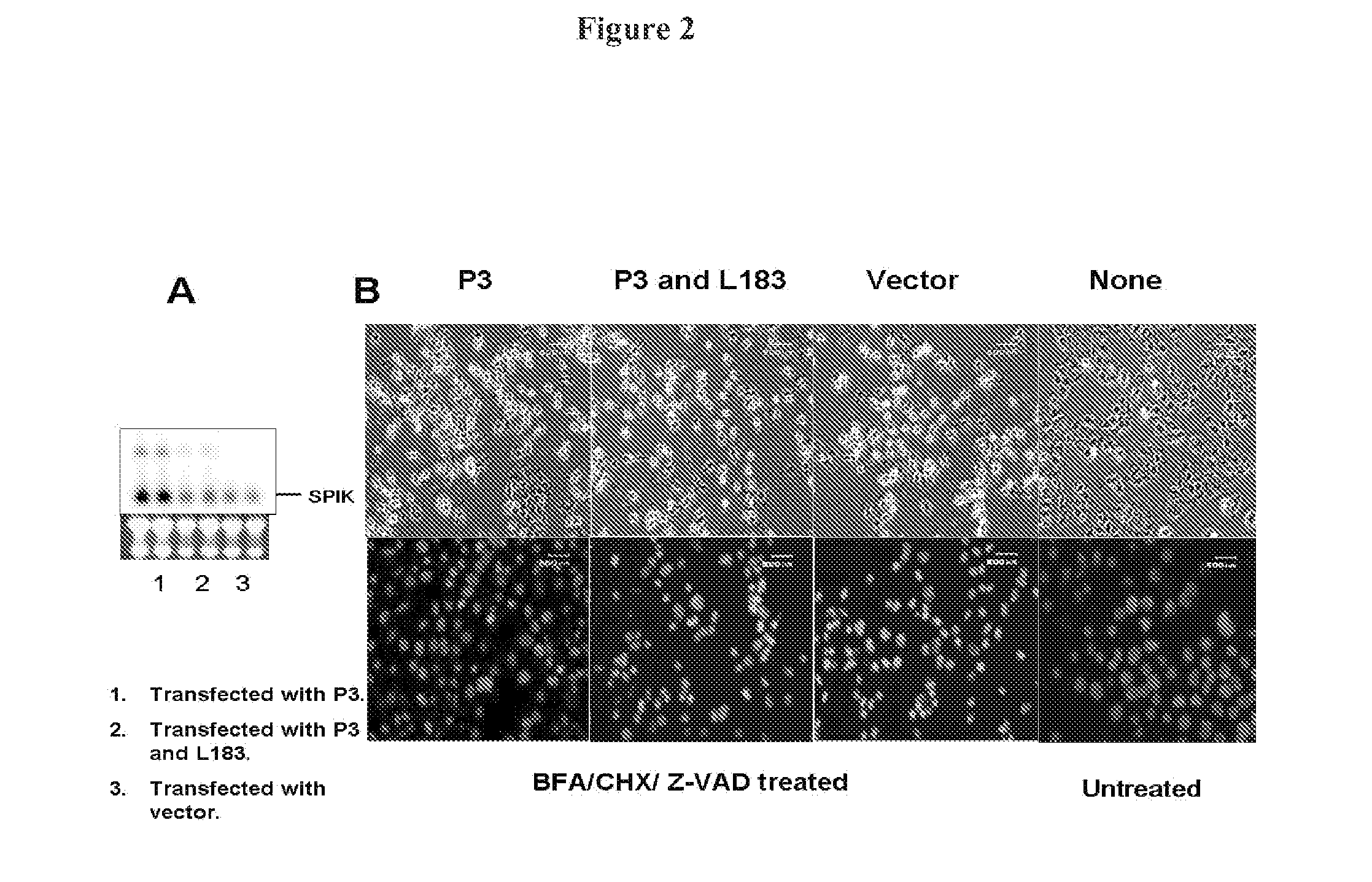 Serine protease inhibitor kazal antibodies