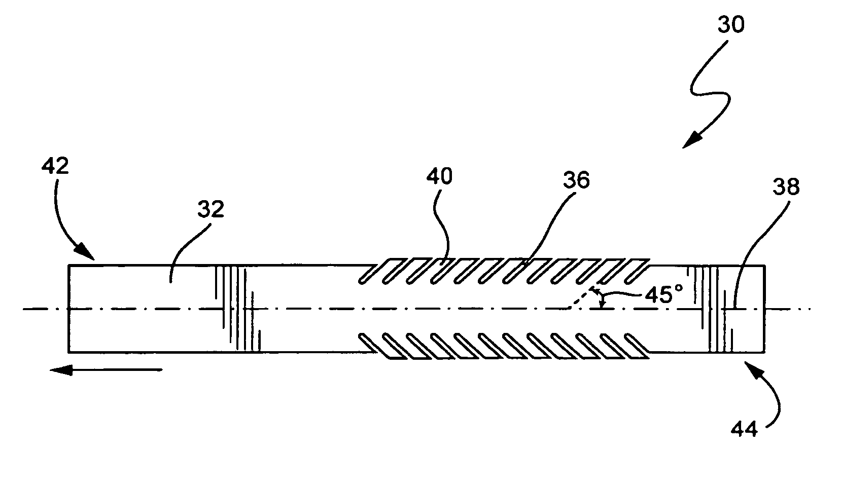 Re-tightenable stator body wedge system