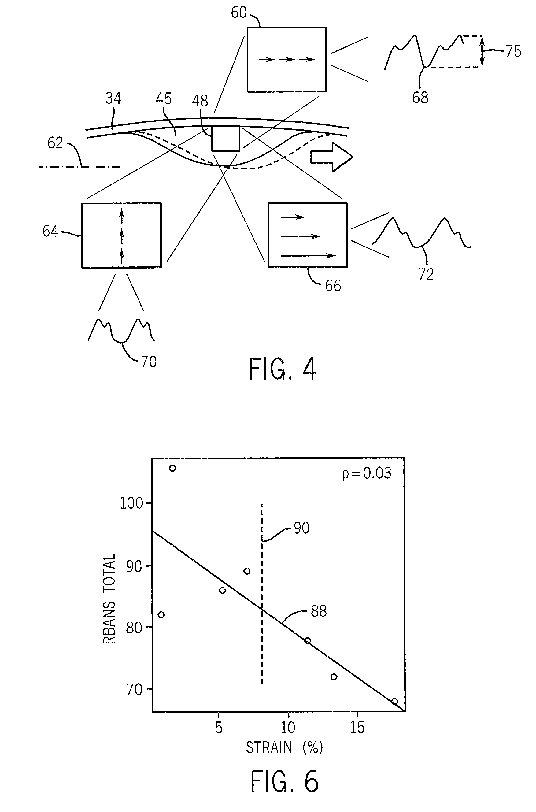 Characterization of vulnerable plaque using dynamic analysis