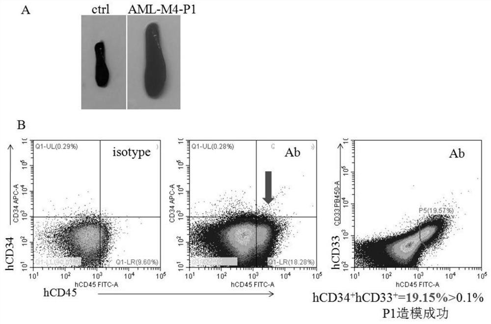 PDX model establishing method for granulocyte tumors