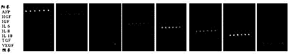 Antibody chip for adopting in early screening and diagnosis of liver cancer, and kit thereof