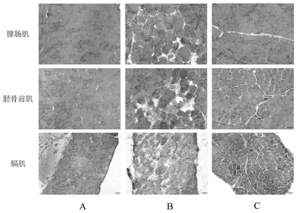 Application of SEW2871 in preparation of medicine for treating muscular dystrophy