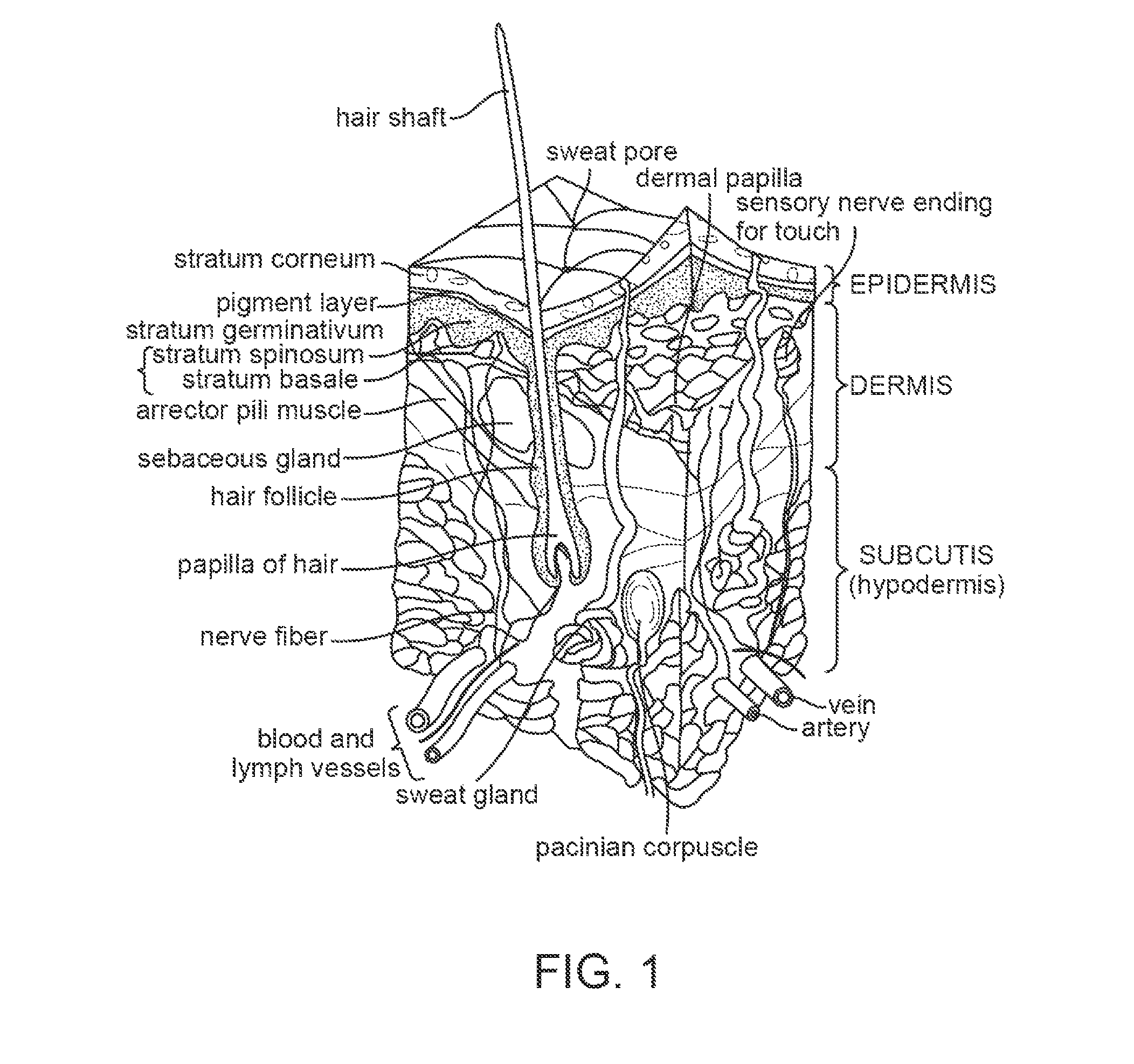 Microneedle electrode