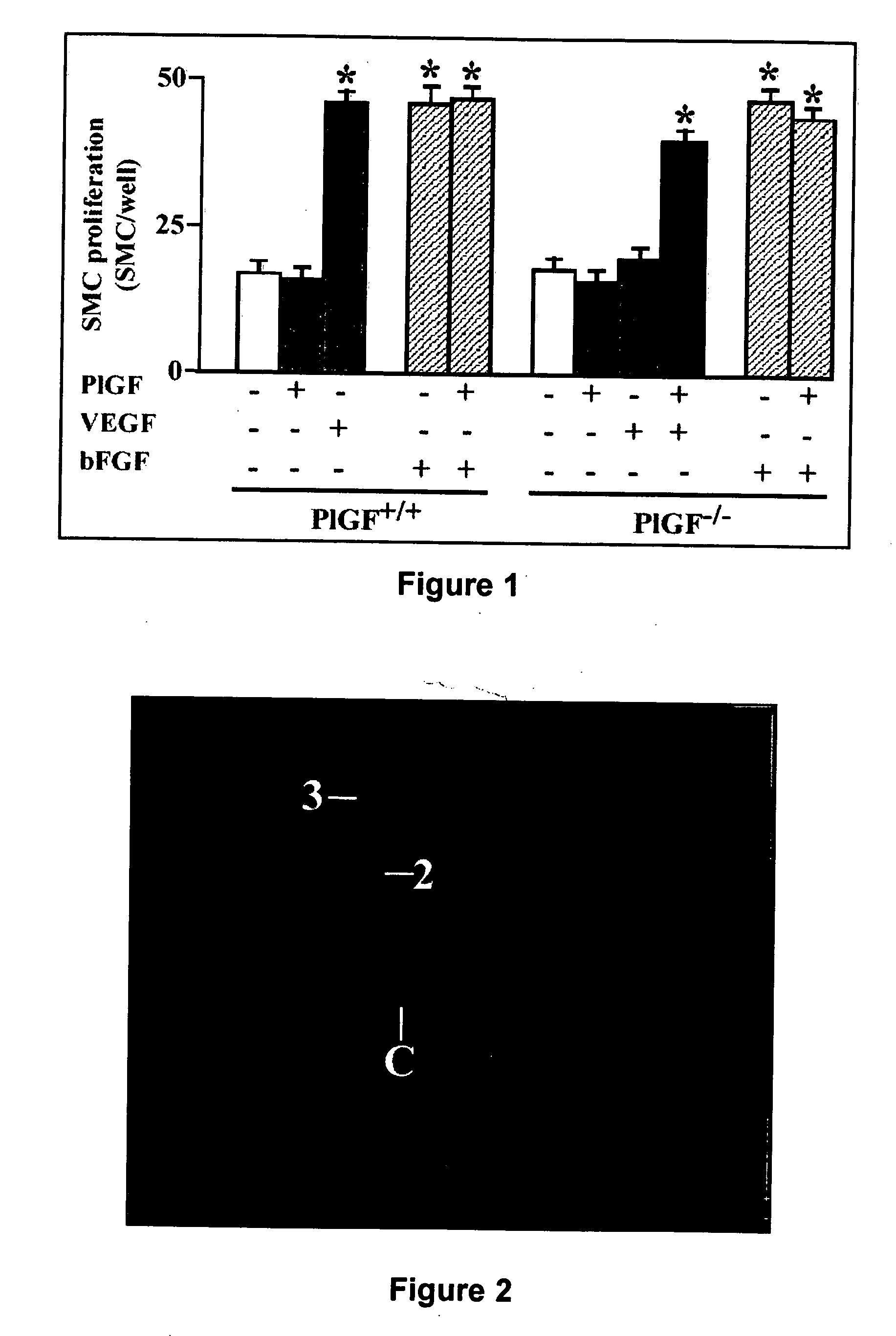 Use of placental growth factor for preventing or treating ischemic diseases or stroke