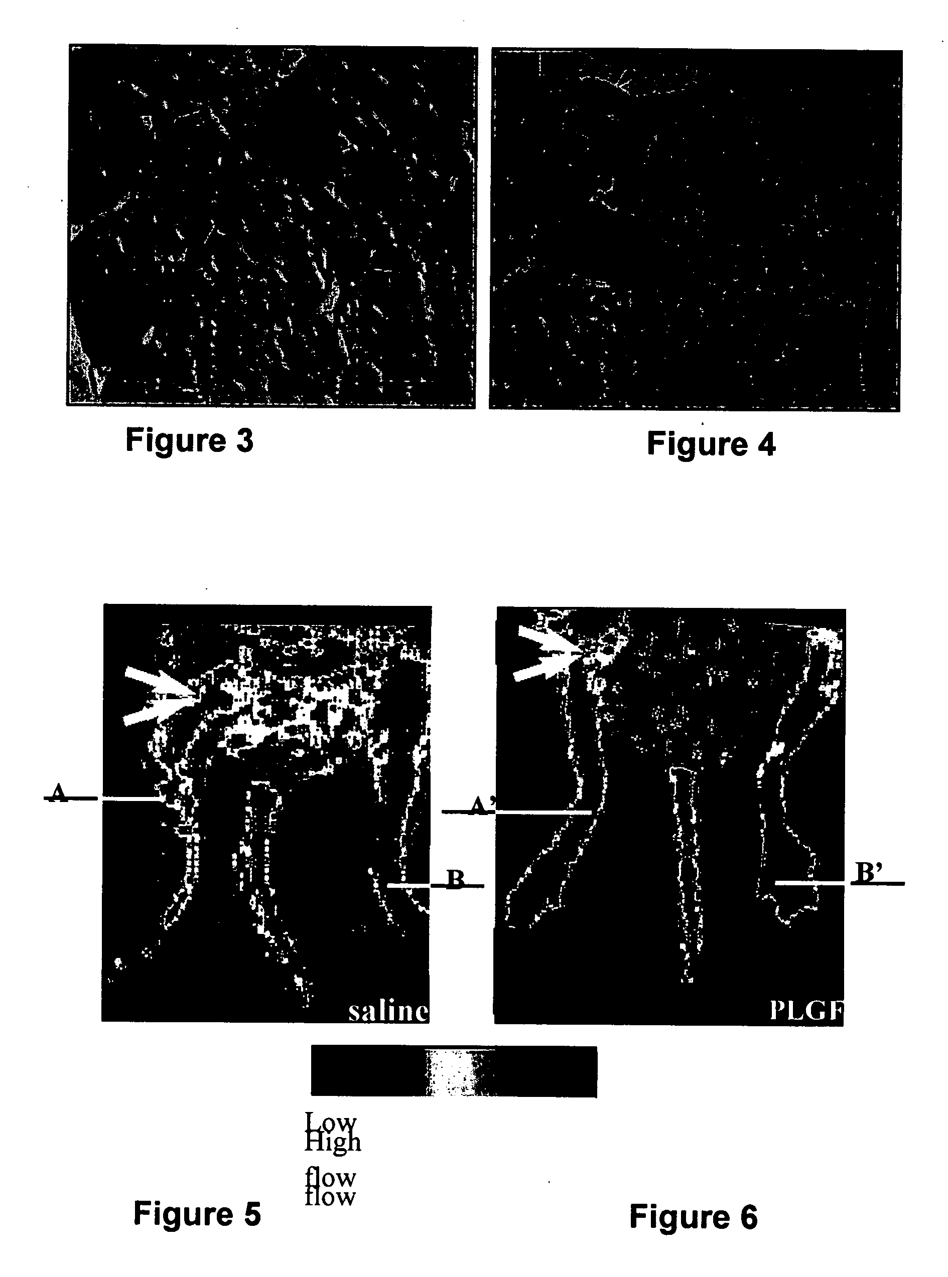 Use of placental growth factor for preventing or treating ischemic diseases or stroke