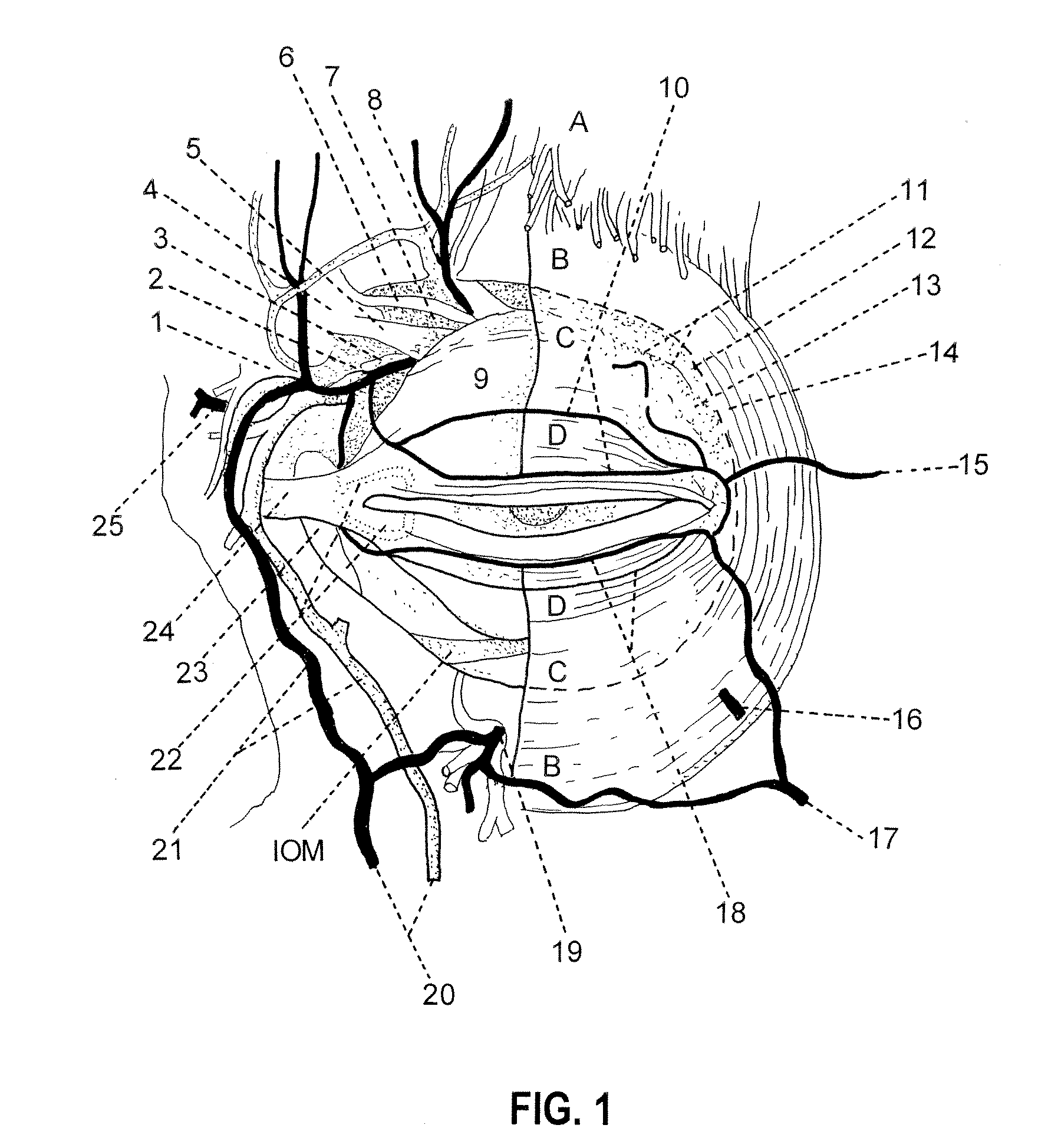 Methods and compositions for sustained delivery of drugs