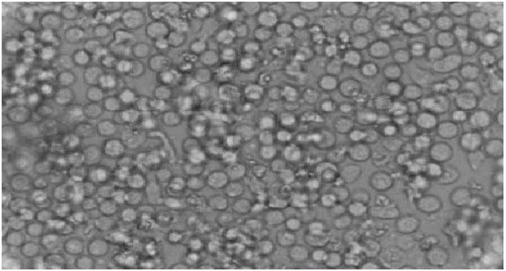 Preparation method of CIK (cytokine-induced killer) cells