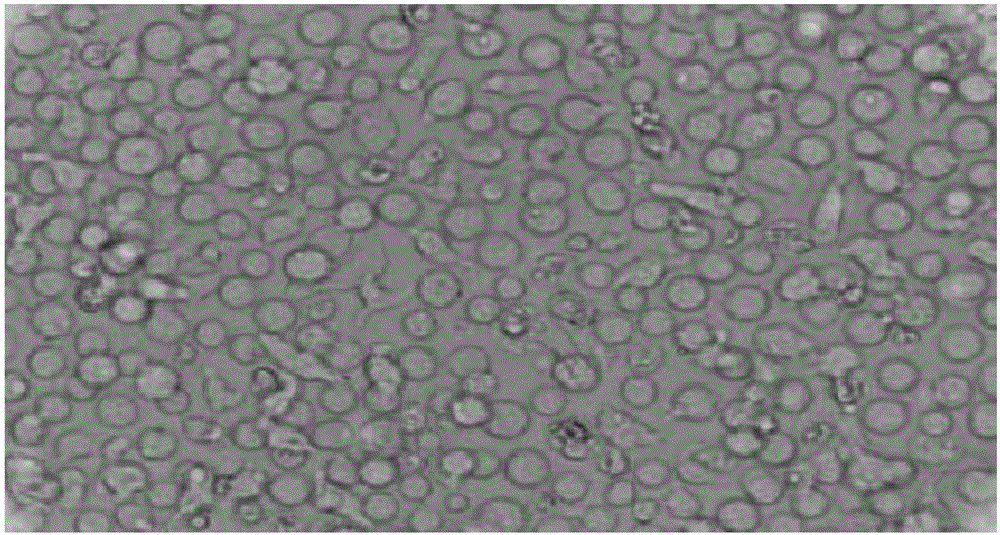 Preparation method of CIK (cytokine-induced killer) cells