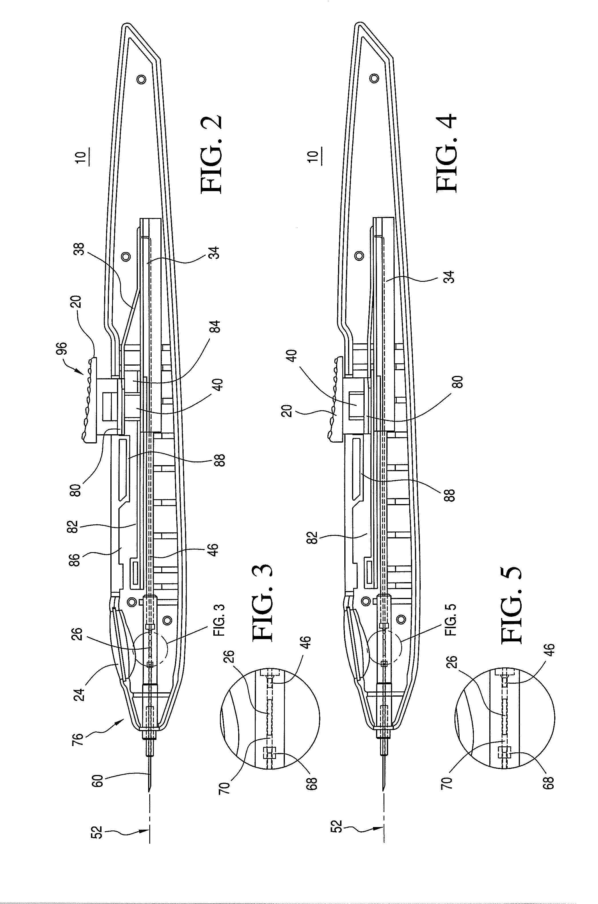 Ocular Implantation Device