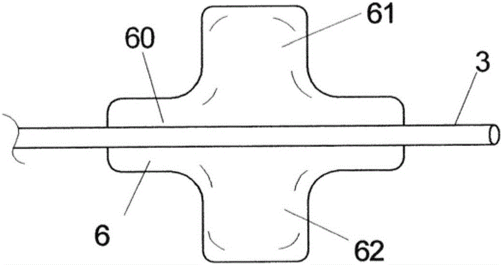 Device for the transcutaneous implantation of epicardial pacemaker electrodes