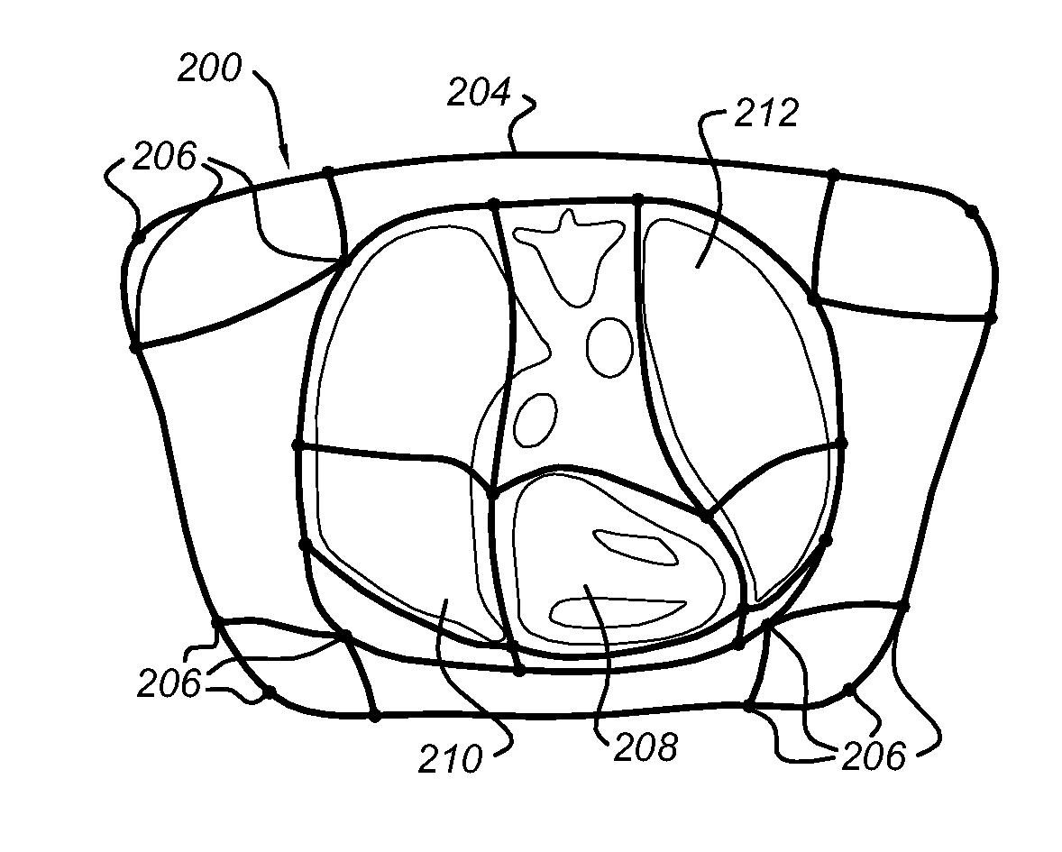 Method of and arrangement for linking image coordinates to coordinates of reference model