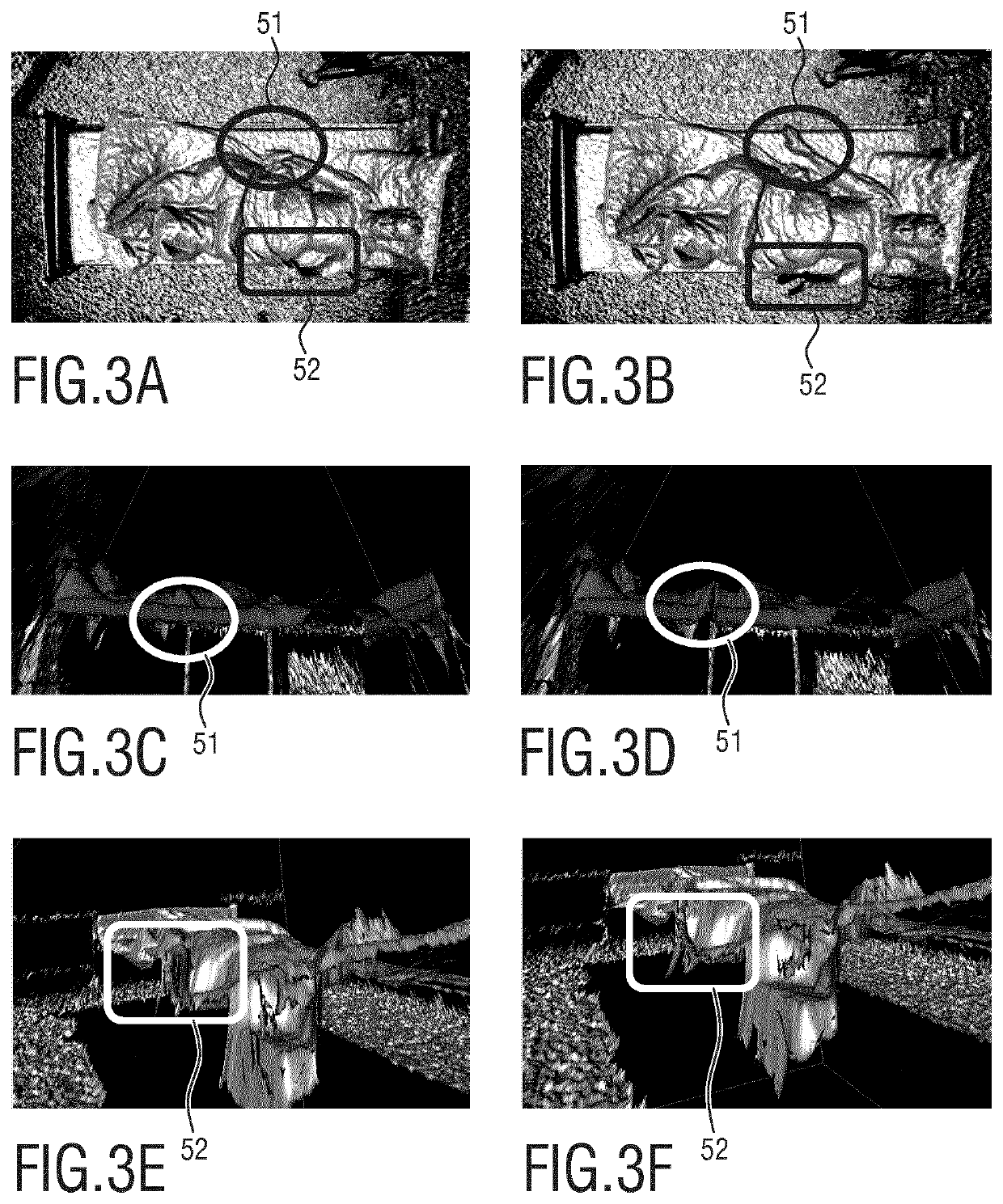 Device, system and method for detecting body movement of a patient