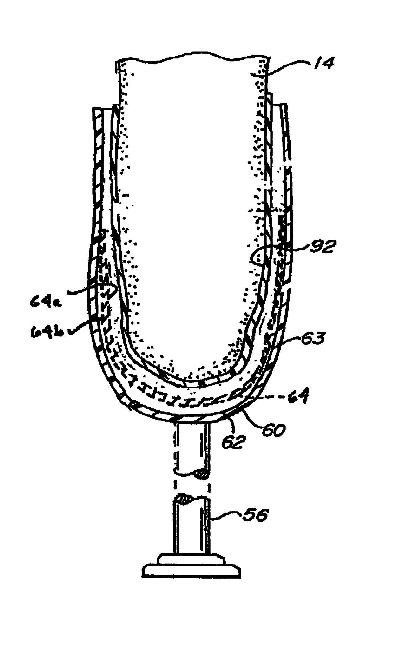 Socket liner for artificial limb