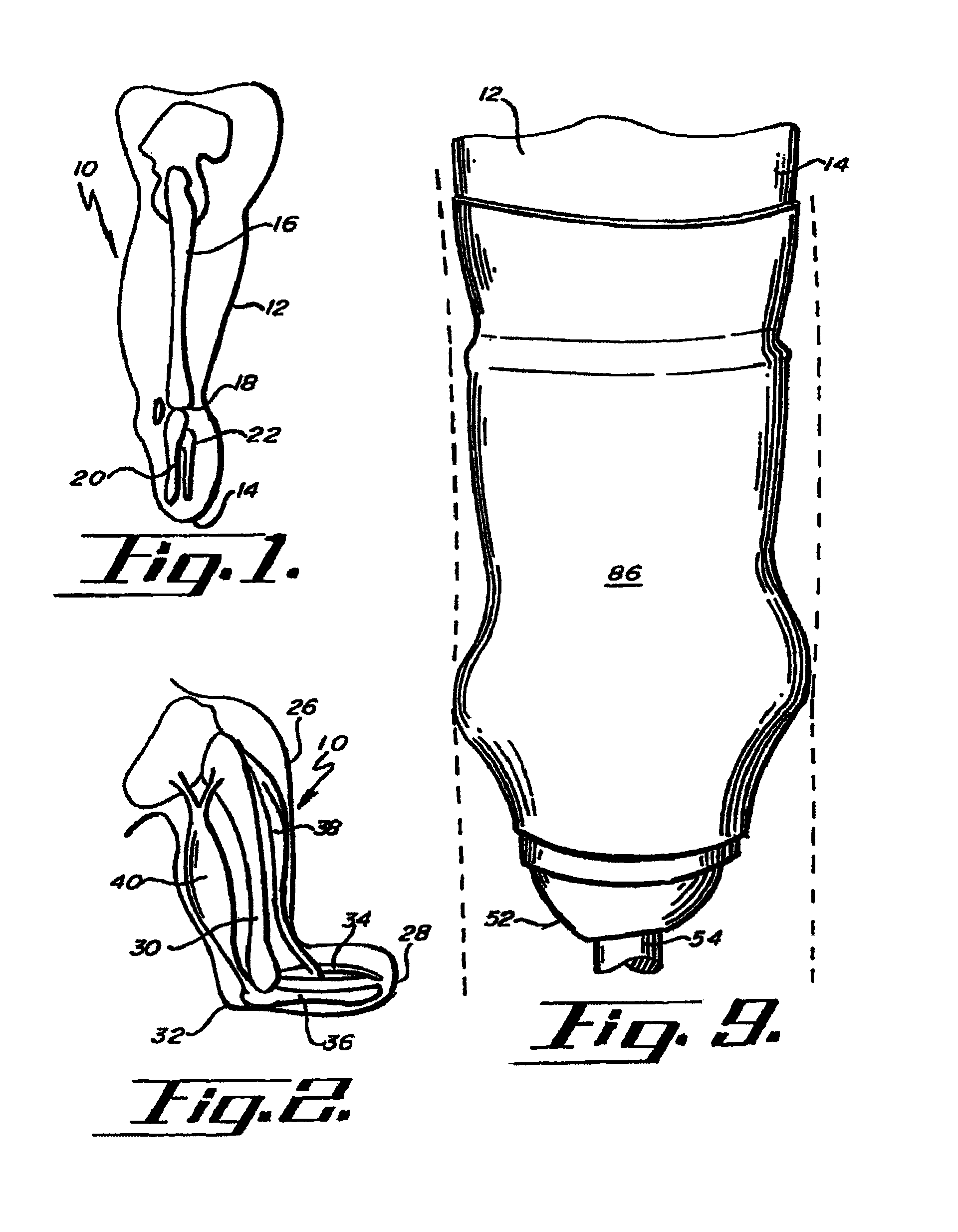 Socket liner for artificial limb