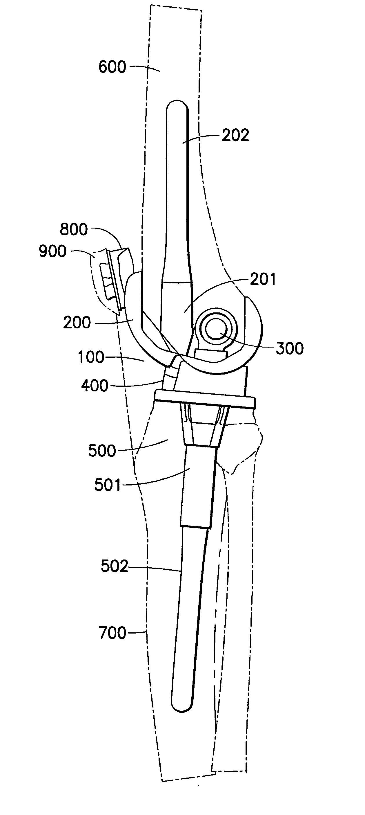 Prosthetic knee