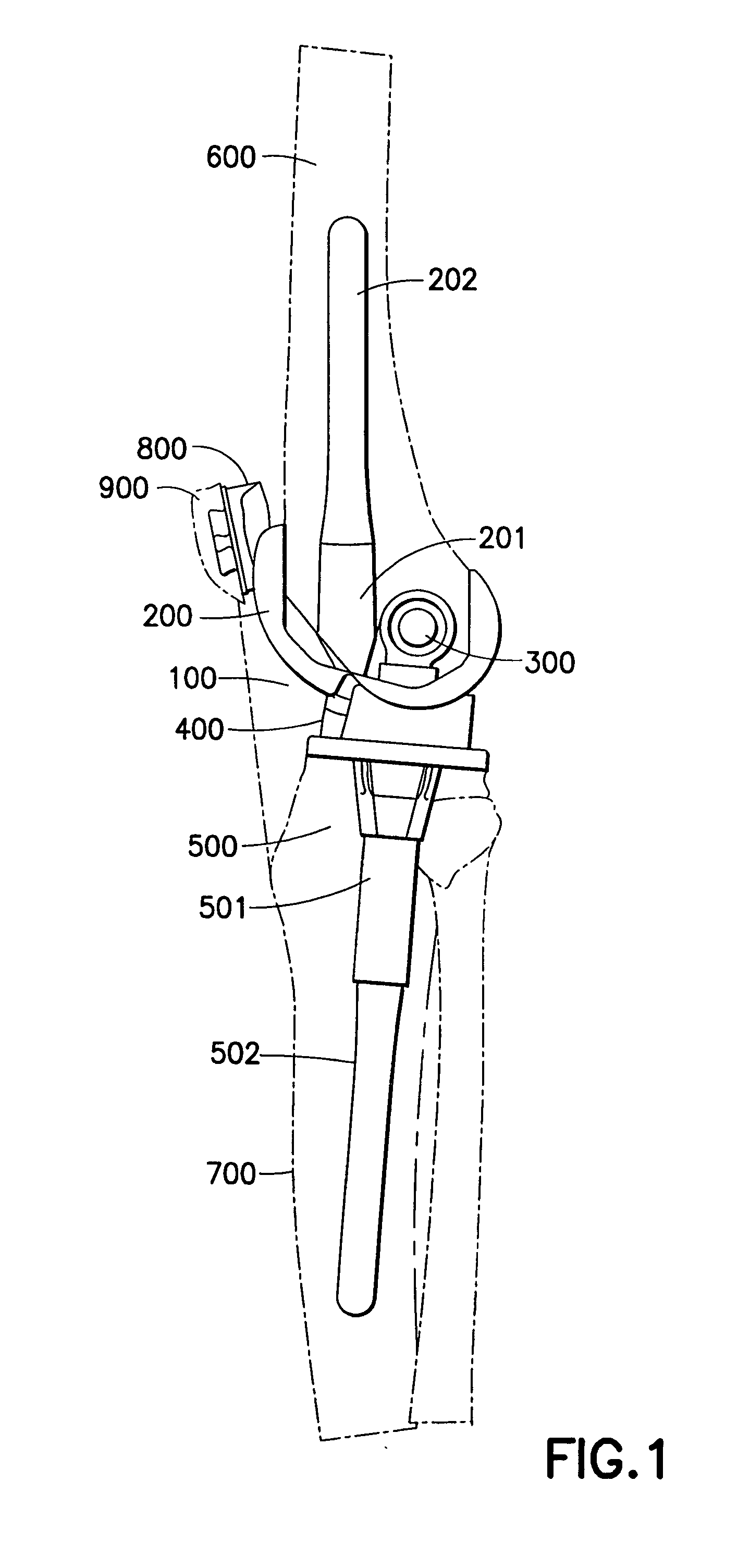 Prosthetic knee