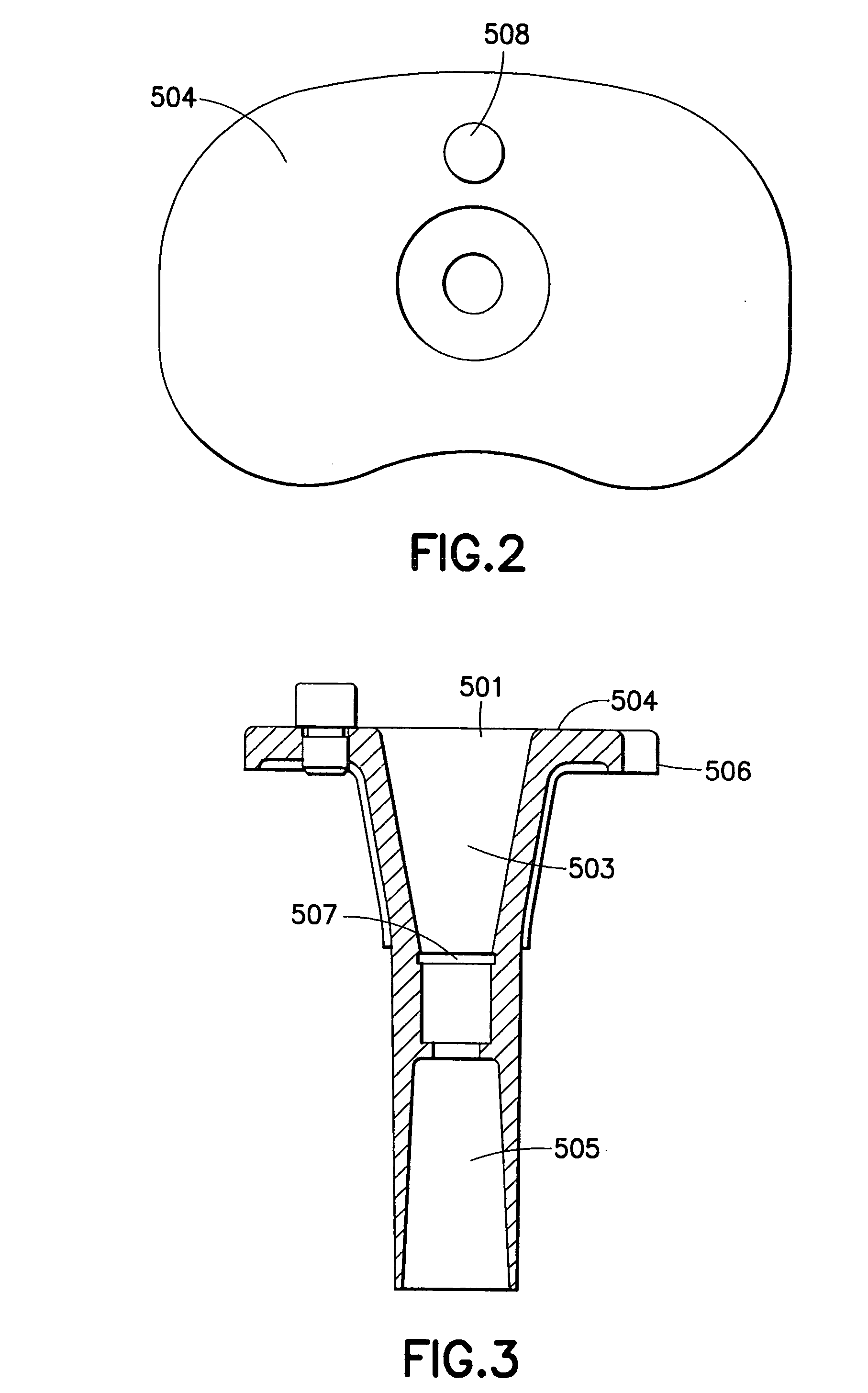 Prosthetic knee