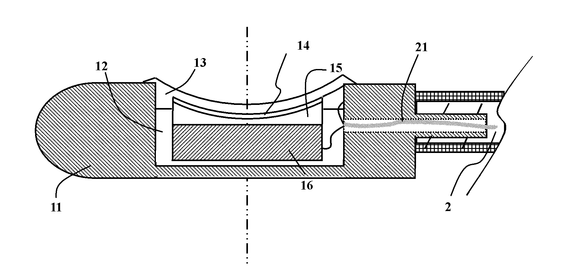 Rotary ultrasonic imaging system