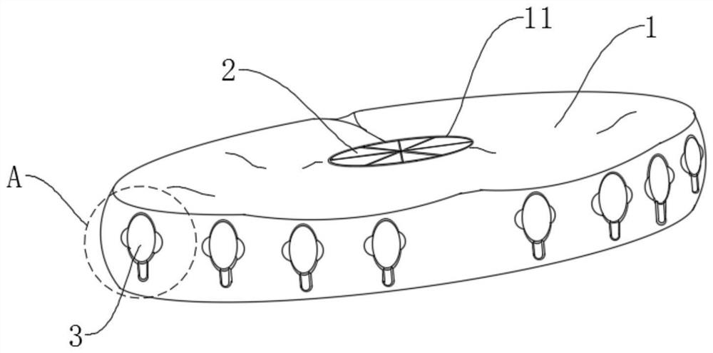 Pressurizing and healing-promoting cushion used after perianal surgery