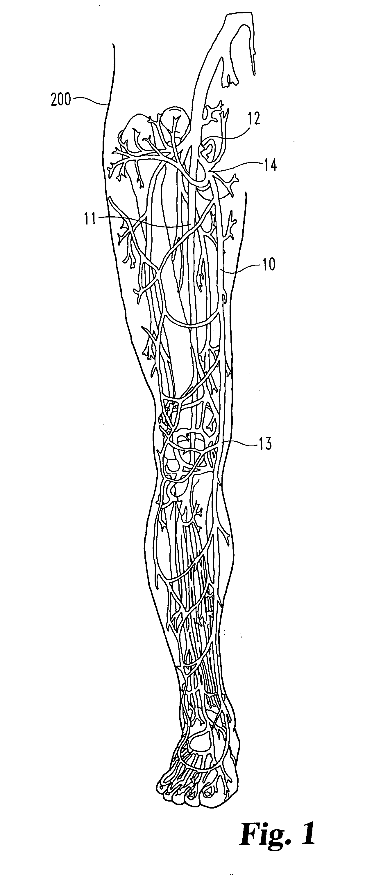 Inverting occlusion devices, methods, and systems