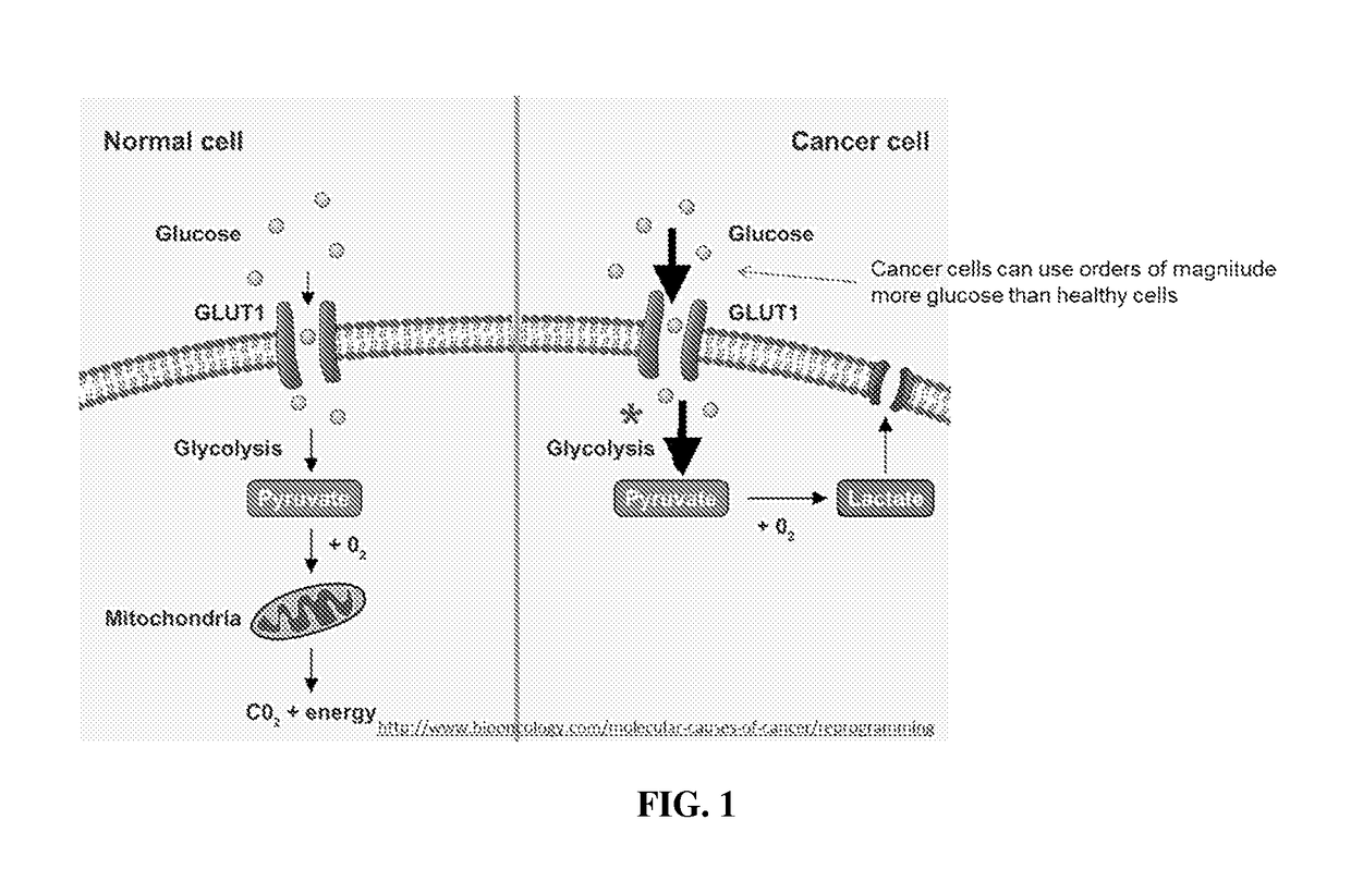 Use of uap inhibitors to inhibit flux through the hexosamine biosynthetic pathway