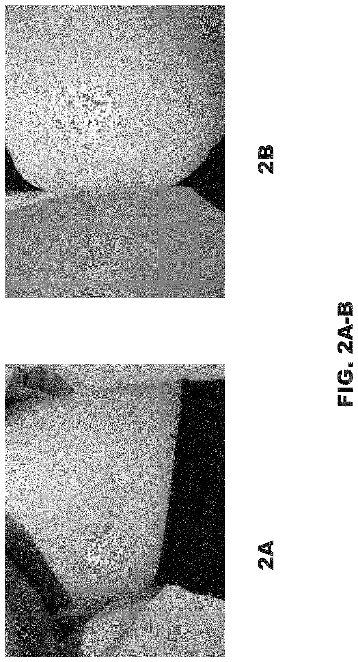 Methods of Treating Residual Lesions of Vascular Anomalies