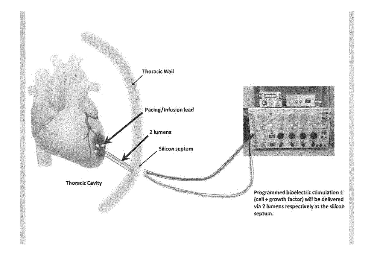 Bioelectric stimulator