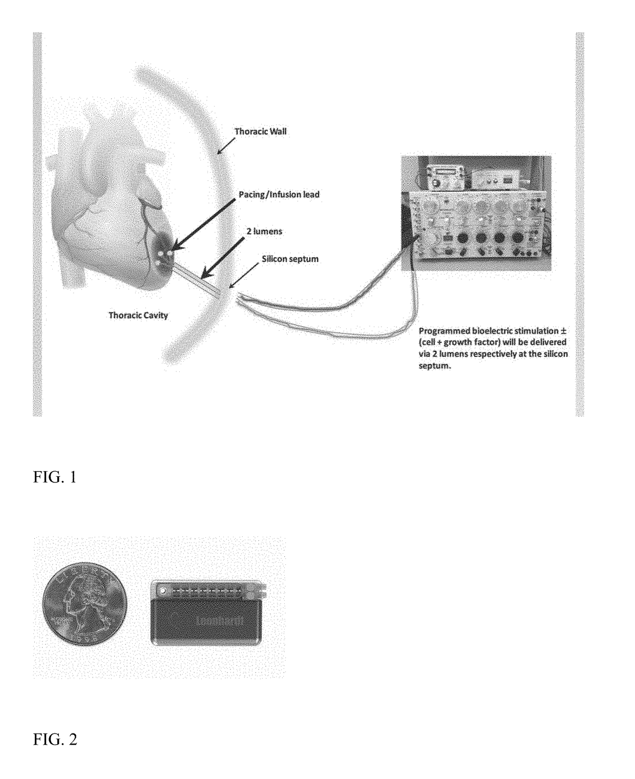 Bioelectric stimulator